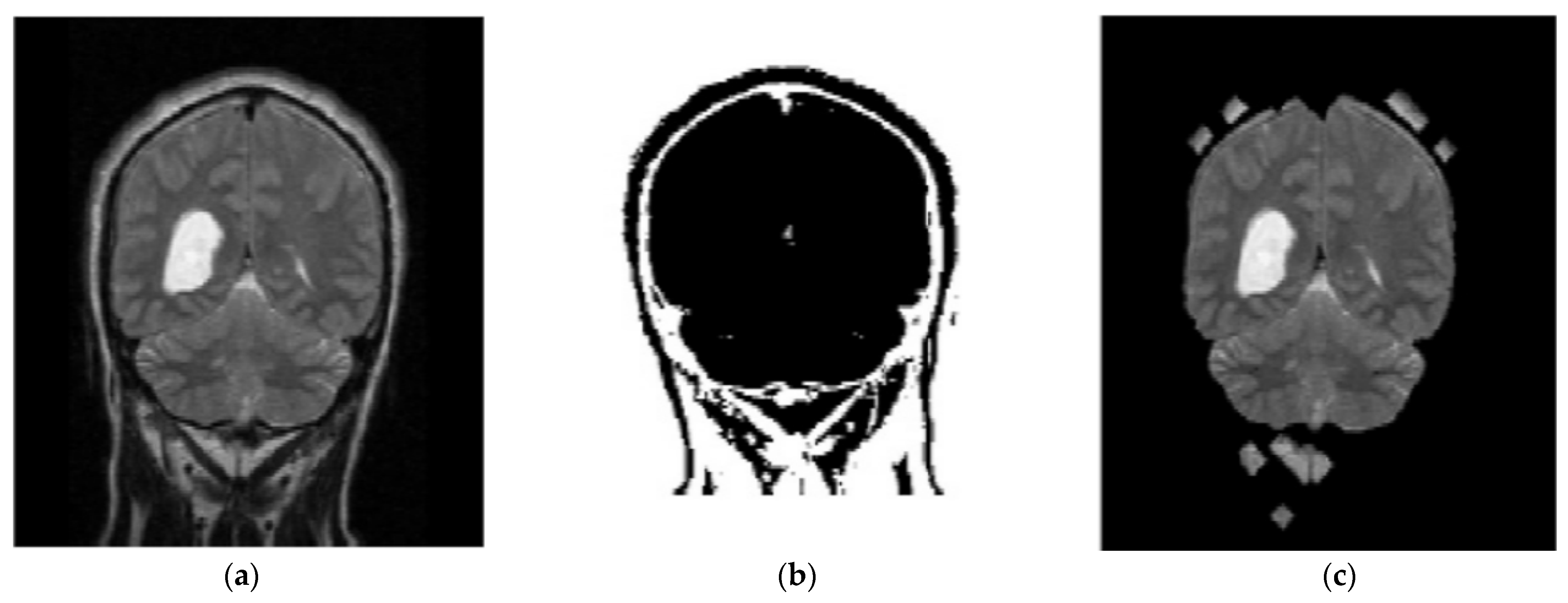 Diagnostics 13 01153 g004 Diagnostics 13 01153 g004