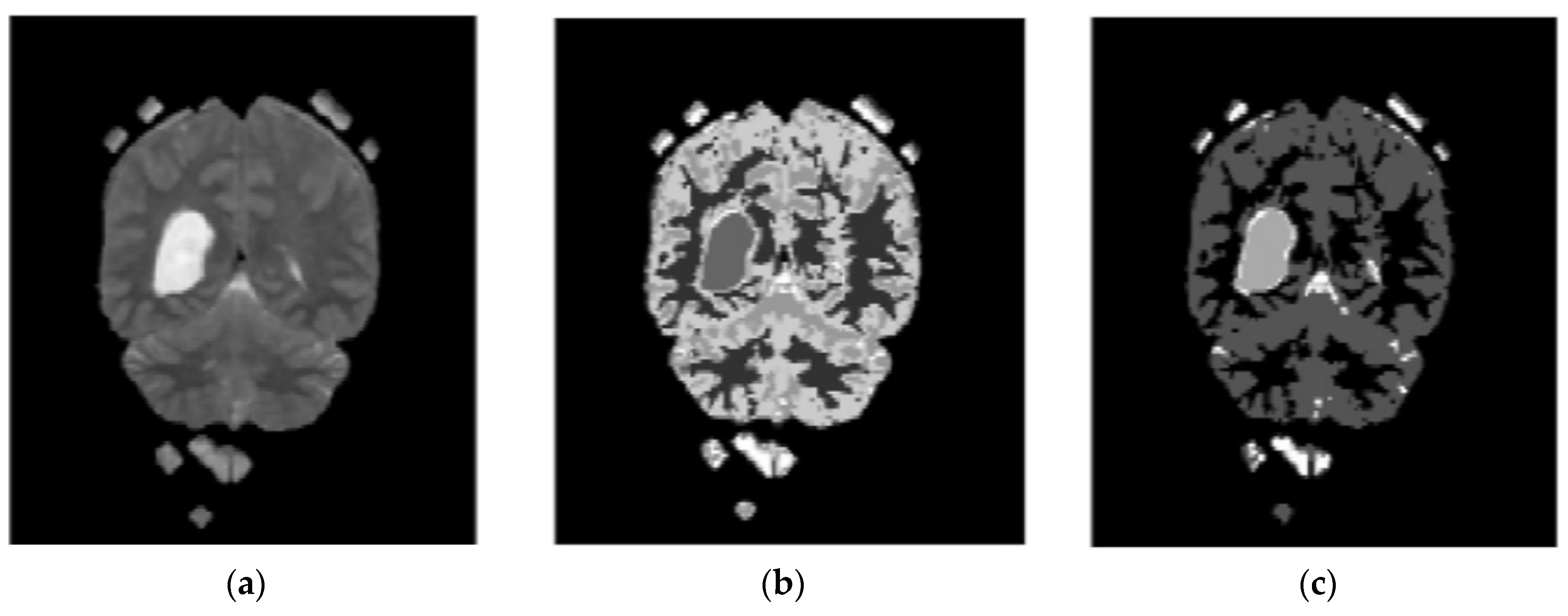 Diagnostics 13 01153 g005 Diagnostics 13 01153 g005