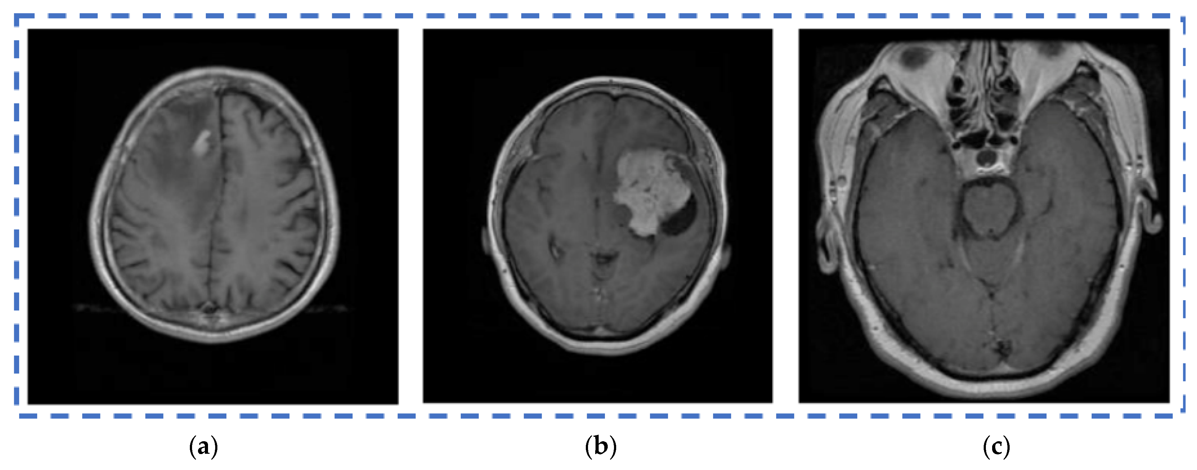 Diagnostics 13 01153 g009 Diagnostics 13 01153 g009
