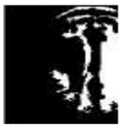 Diagnostics 13 01153 i002 Diagnostics 13 01153 i002