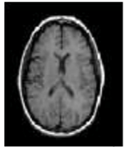 Diagnostics 13 01153 i003 Diagnostics 13 01153 i003