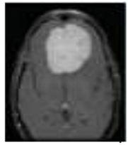 Diagnostics 13 01153 i004 Diagnostics 13 01153 i004