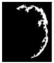 Diagnostics 13 01153 i005 Diagnostics 13 01153 i005