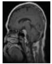 Diagnostics 13 01153 i006 Diagnostics 13 01153 i006