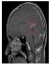 Diagnostics 13 01153 i007 Diagnostics 13 01153 i007