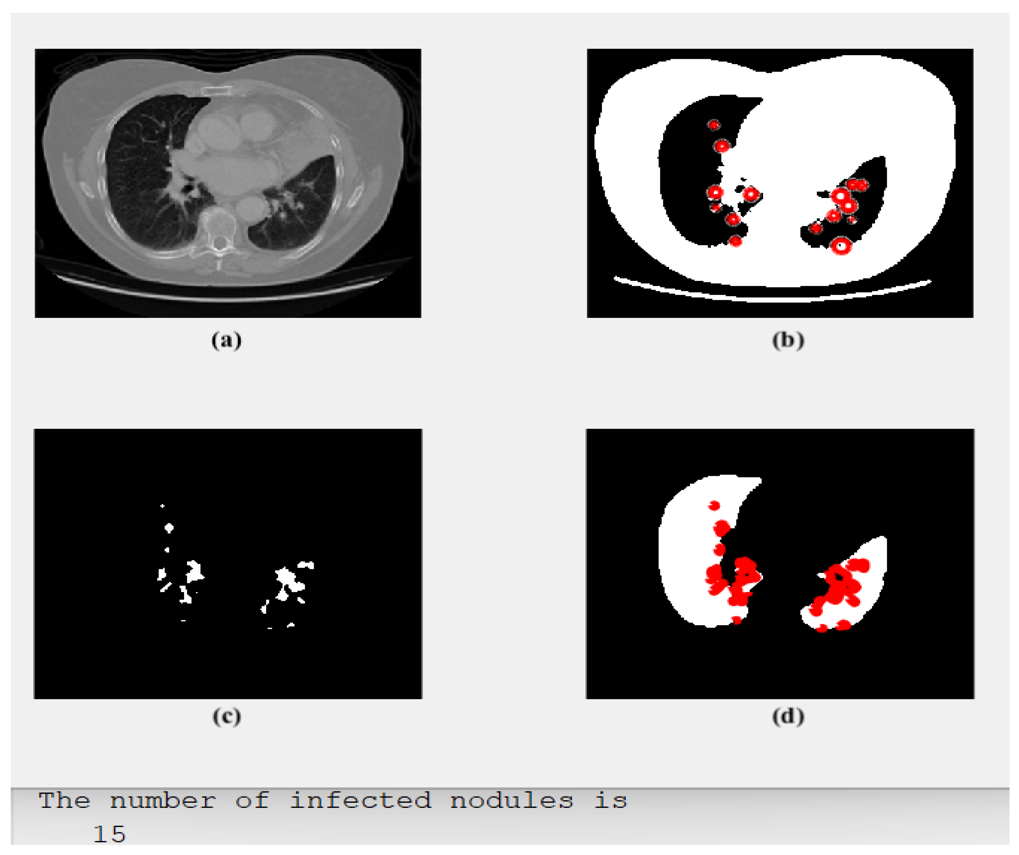 Diagnostics 13 01174 g003 Diagnostics 13 01174 g003