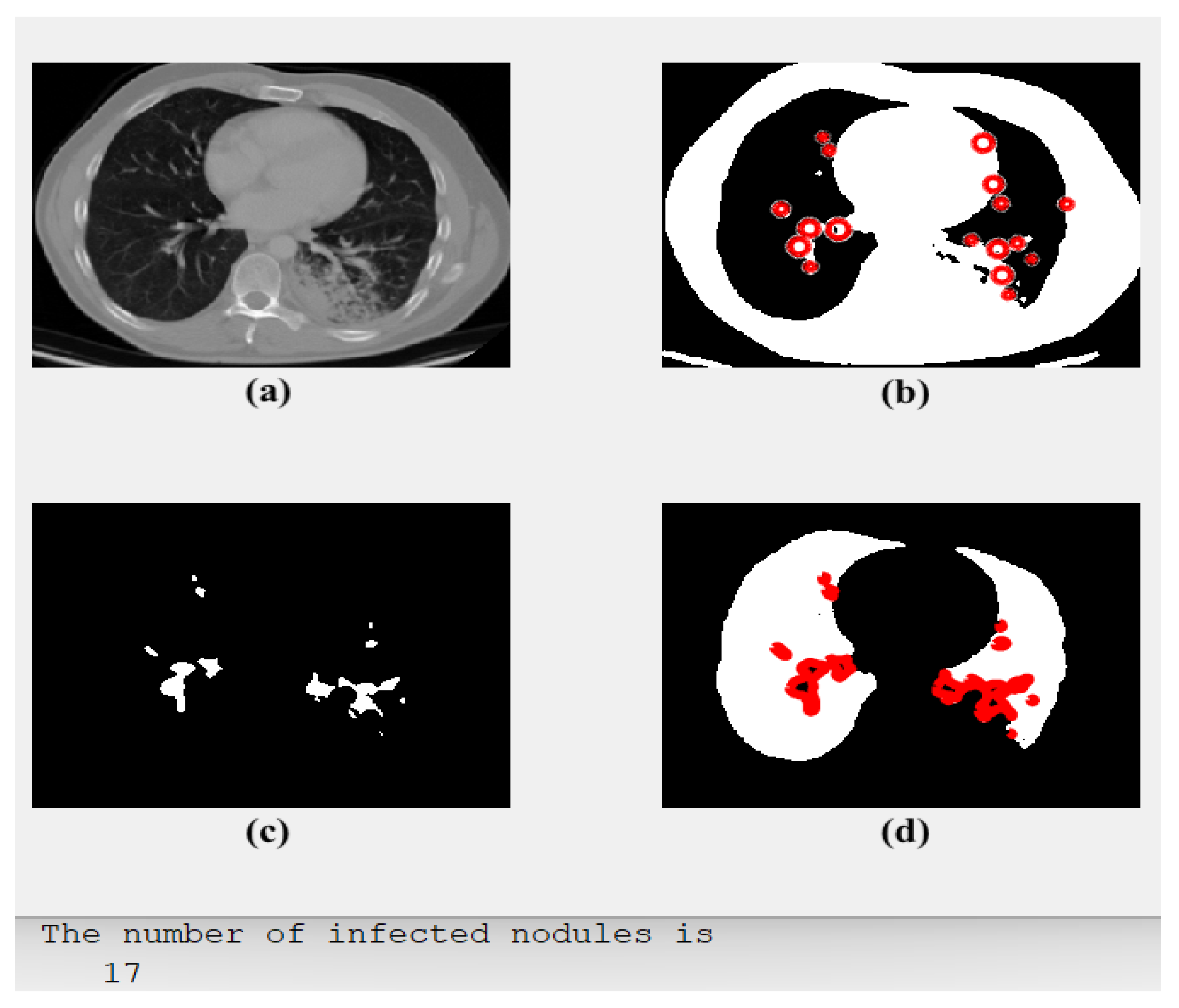 Diagnostics 13 01174 g005 Diagnostics 13 01174 g005