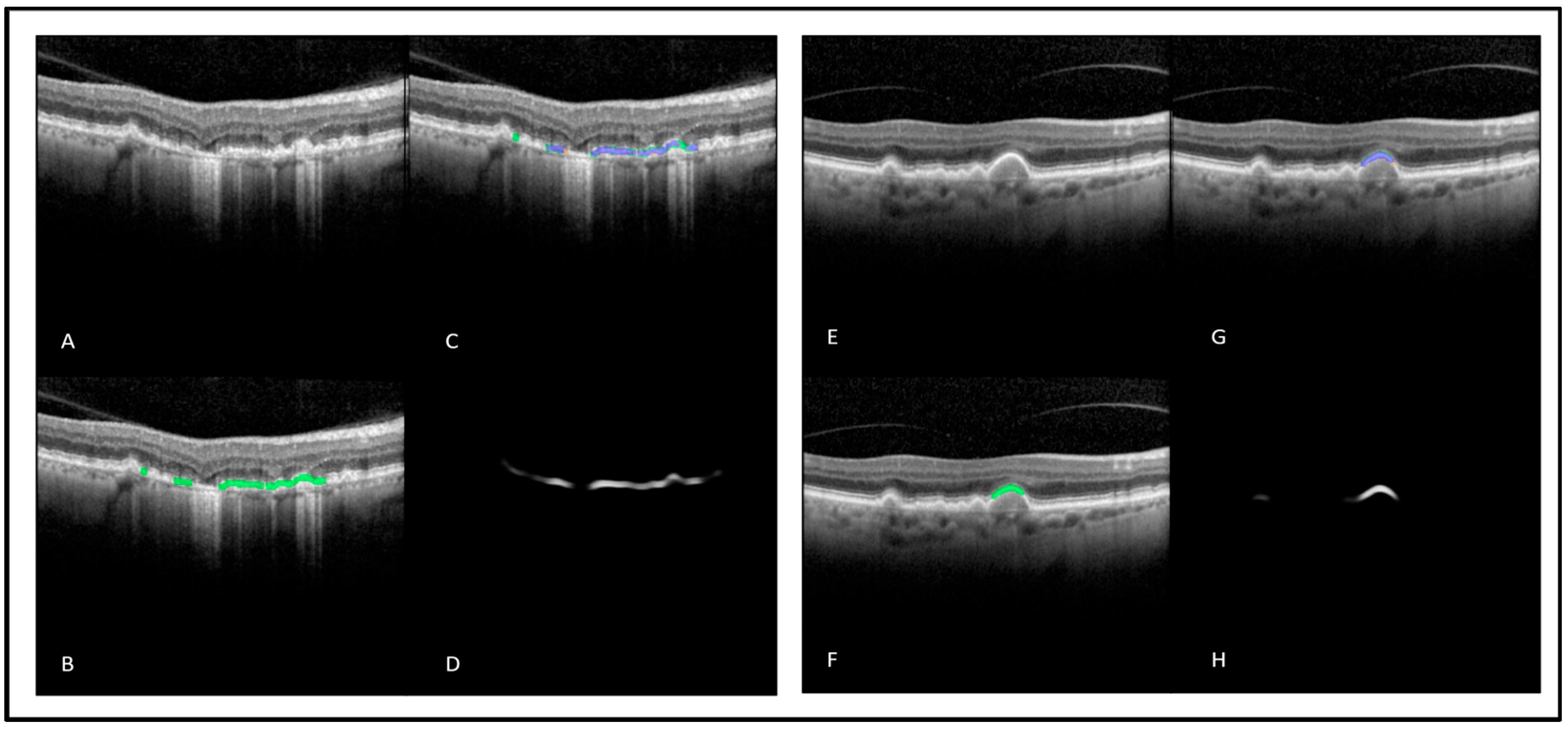 Diagnostics 13 01178 g003 Diagnostics 13 01178 g003