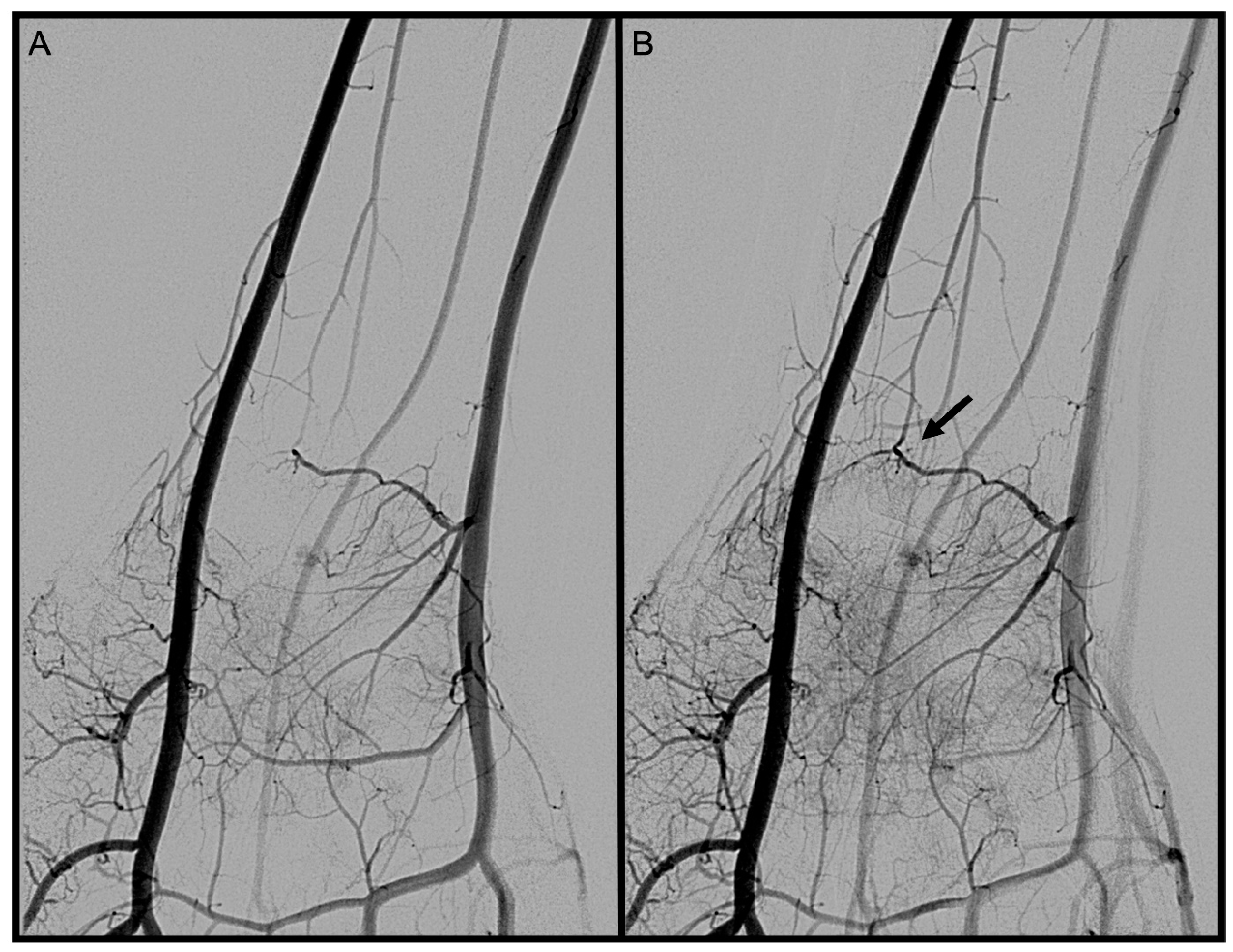 Diagnostics 13 01198 g009 Diagnostics 13 01198 g009