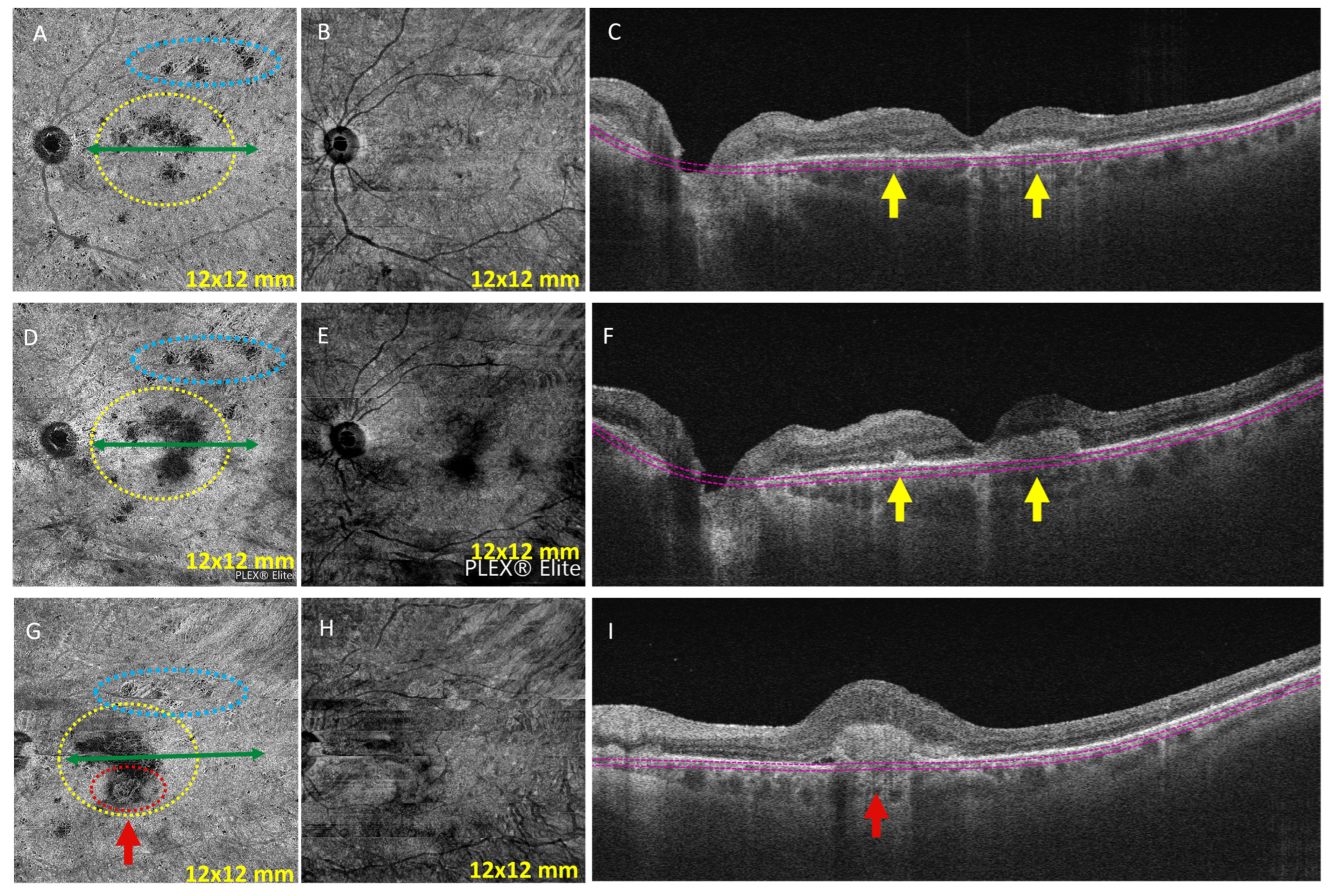 Diagnostics 13 01296 g004 Diagnostics 13 01296 g004