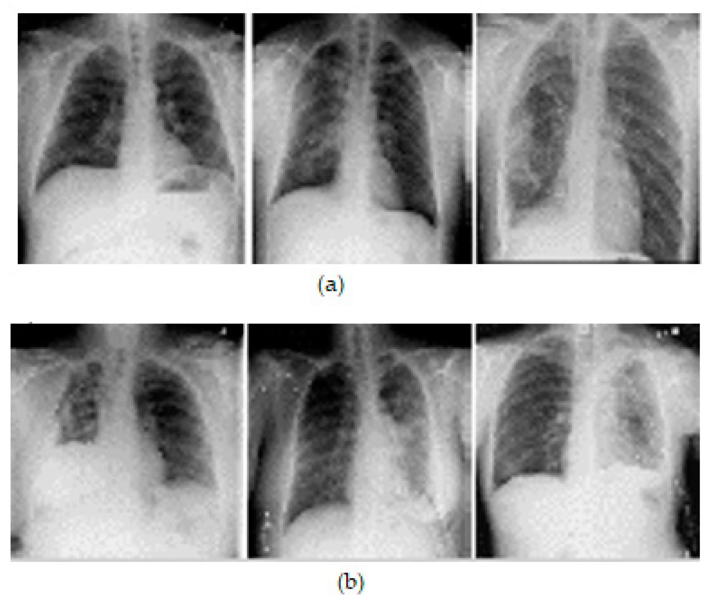 Diagnostics 13 01305 g003 Diagnostics 13 01305 g003