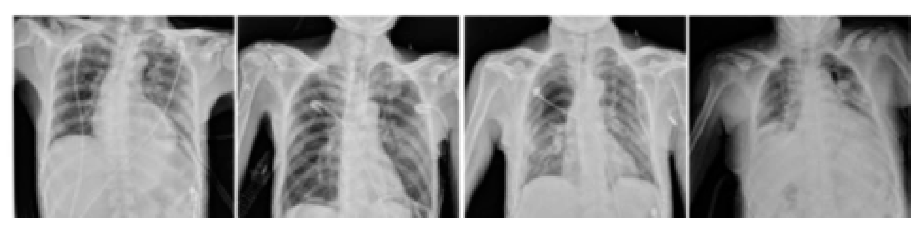 Diagnostics 13 01305 g004 Diagnostics 13 01305 g004