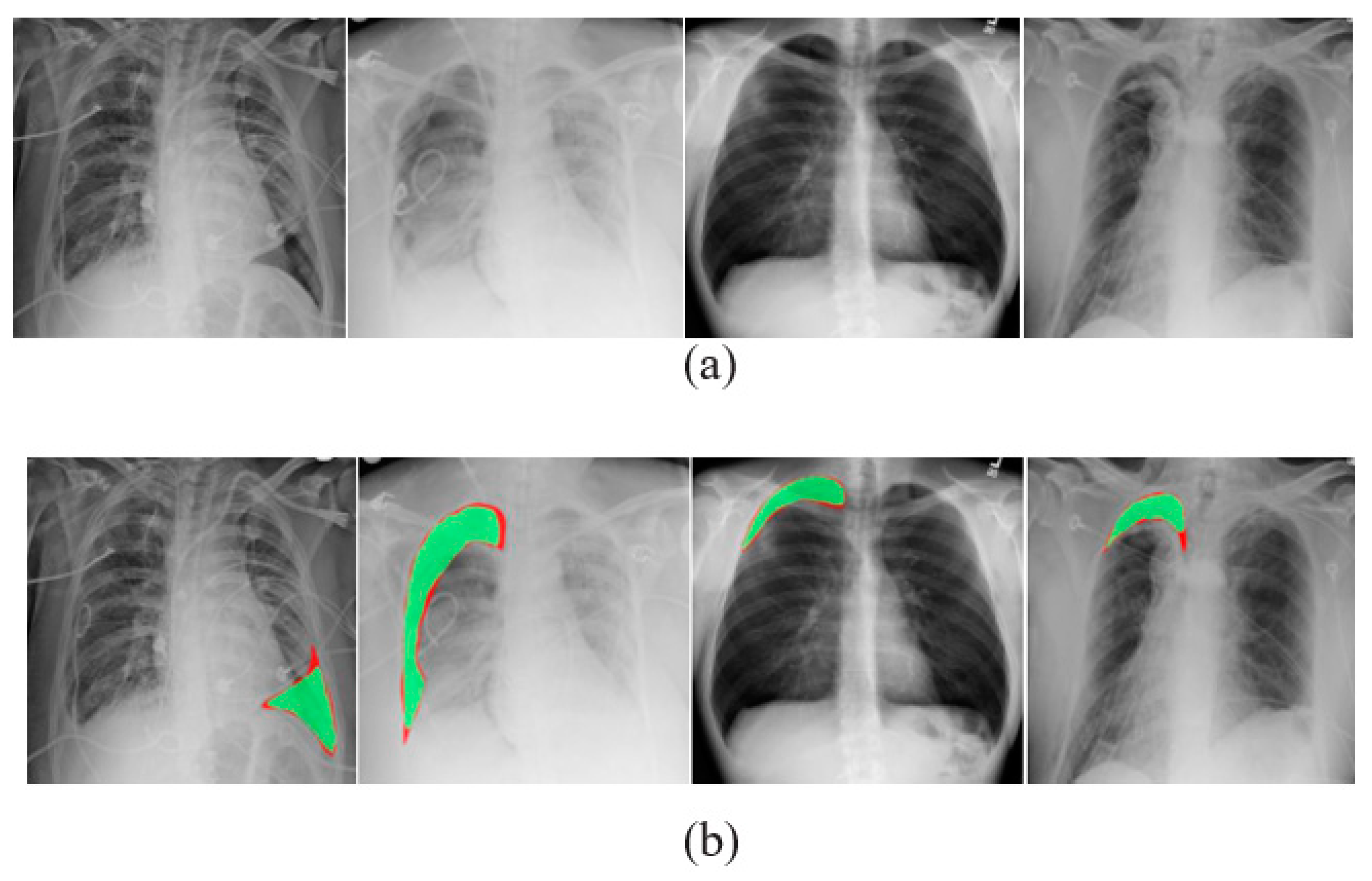 Diagnostics 13 01305 g006 Diagnostics 13 01305 g006