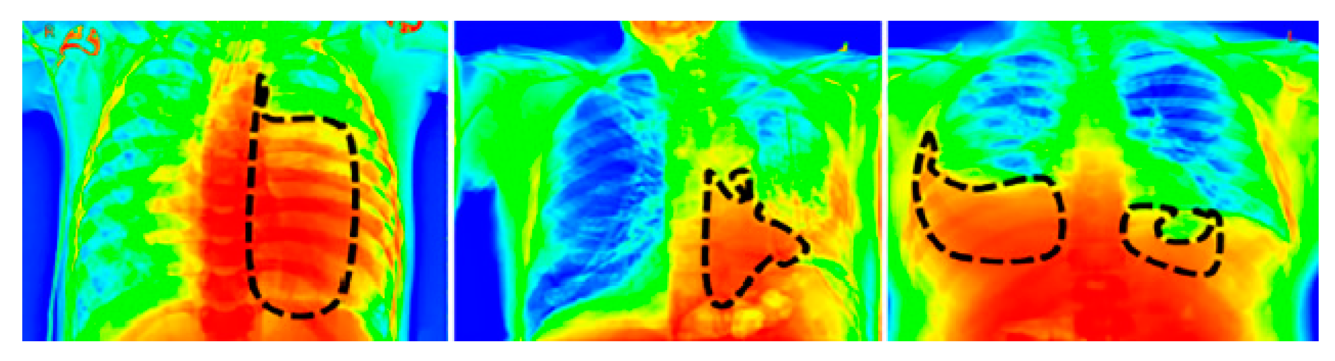 Diagnostics 13 01305 g008 Diagnostics 13 01305 g008