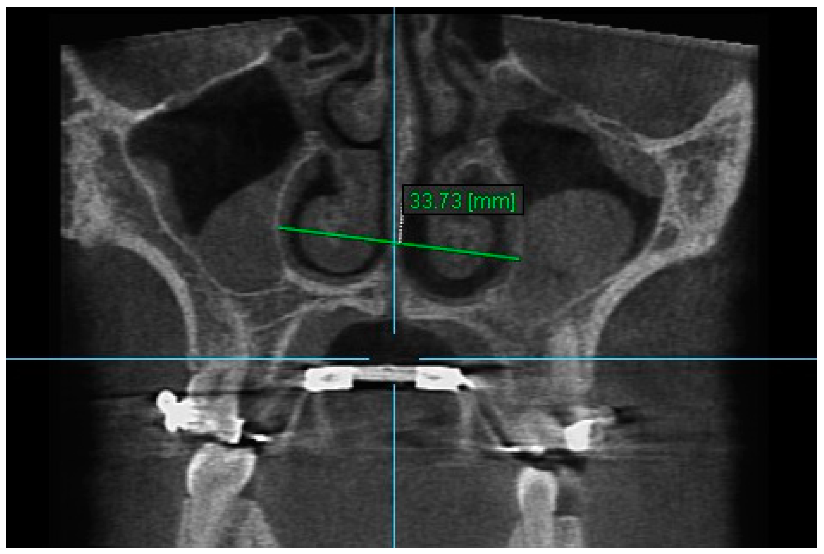 Diagnostics 13 01322 g003 Diagnostics 13 01322 g003