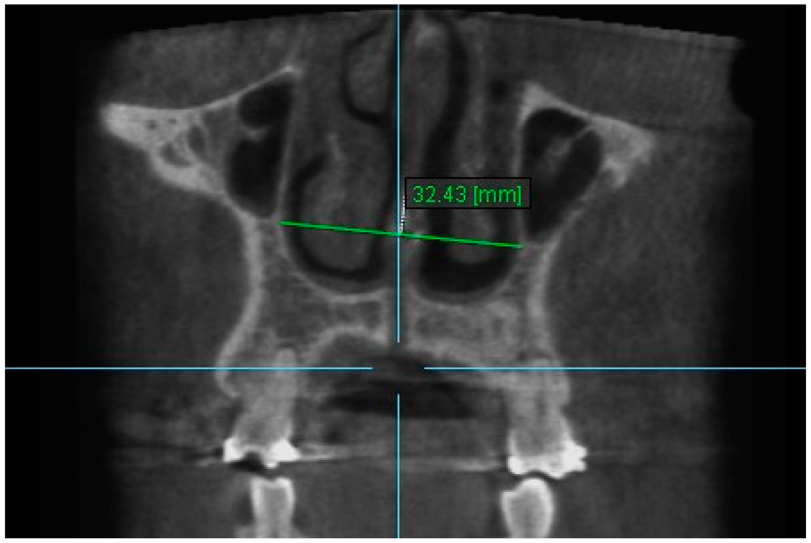 Diagnostics 13 01322 g005 Diagnostics 13 01322 g005