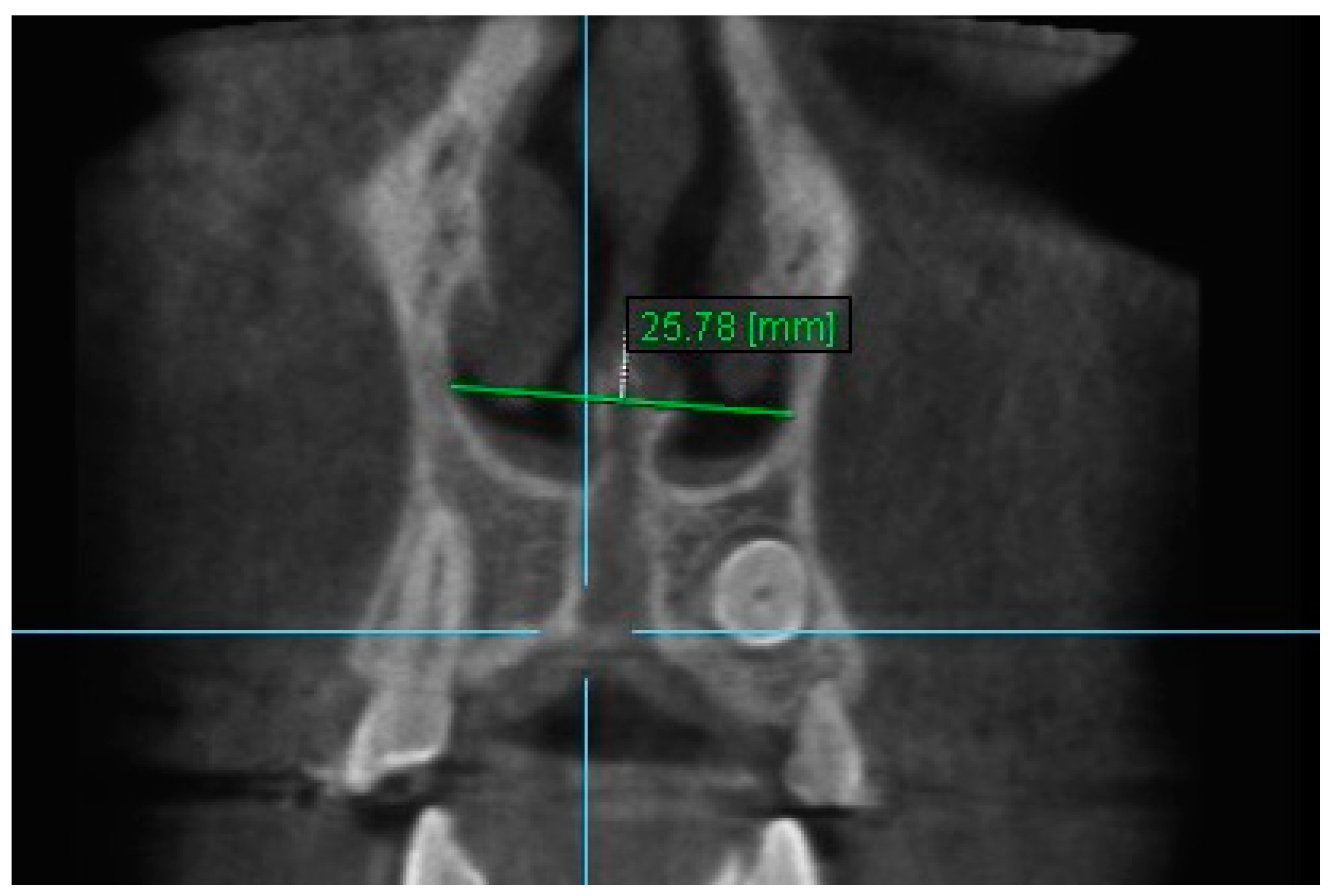 Diagnostics 13 01322 g008 Diagnostics 13 01322 g008