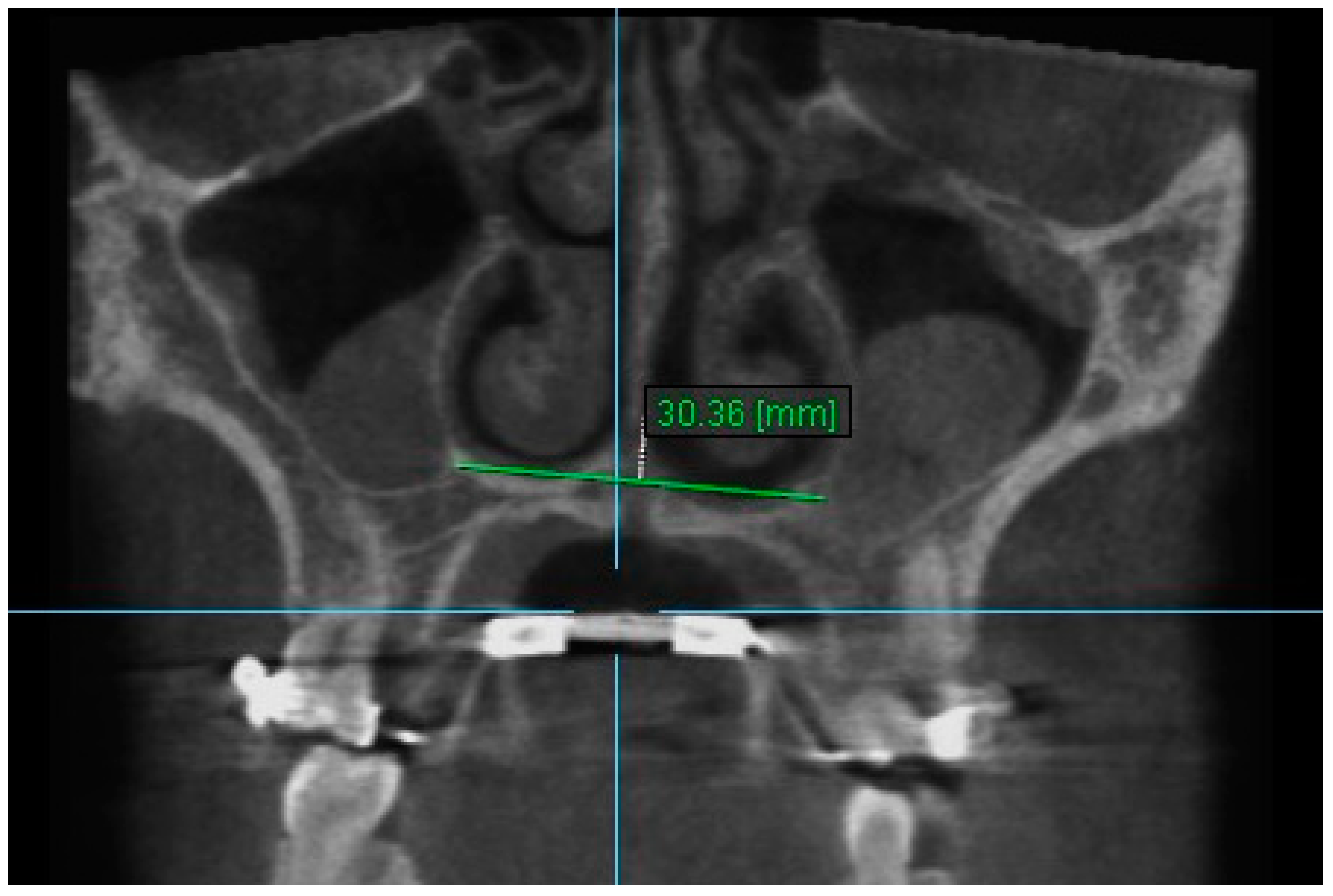 Diagnostics 13 01322 g009 Diagnostics 13 01322 g009