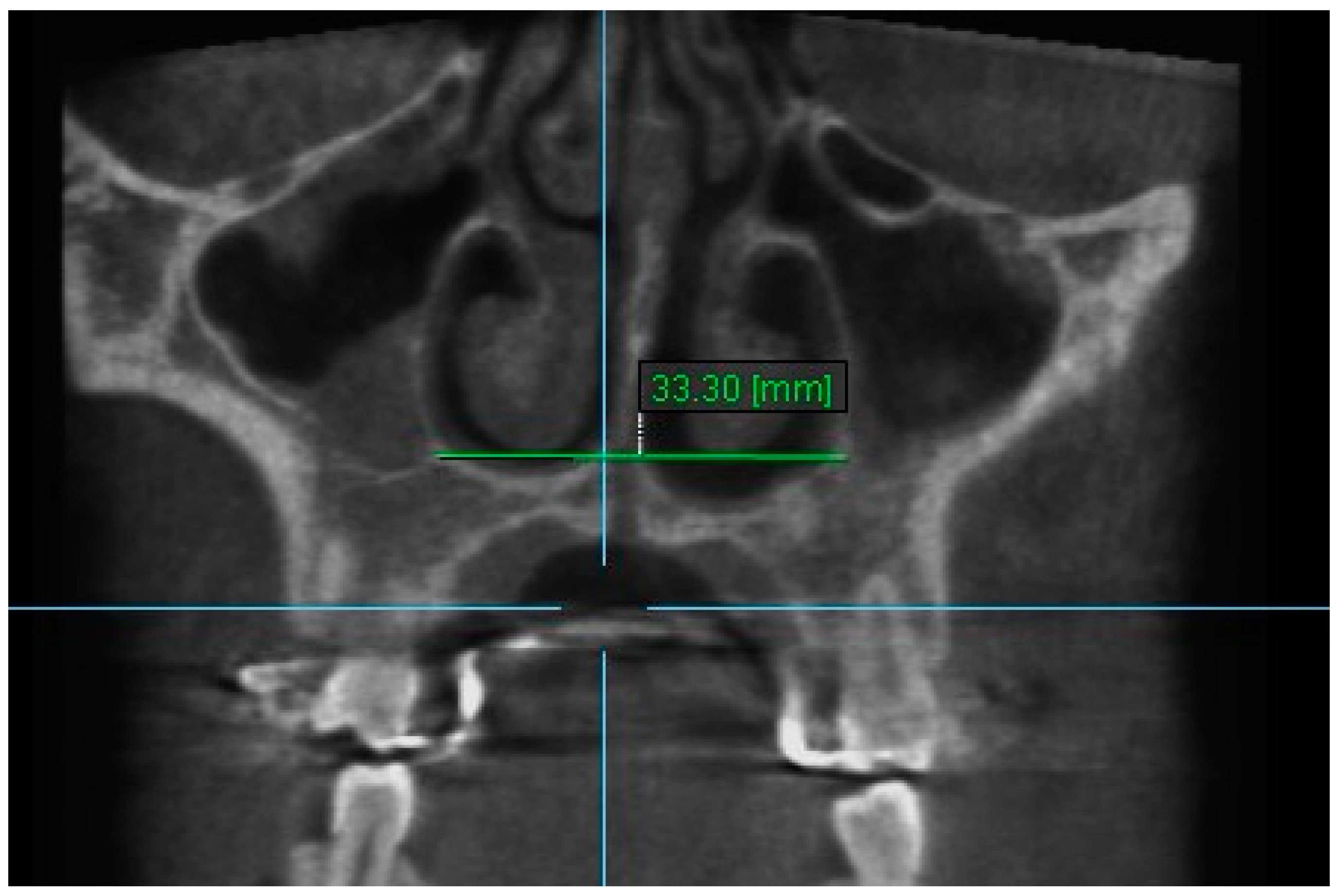 Diagnostics 13 01322 g010 Diagnostics 13 01322 g010