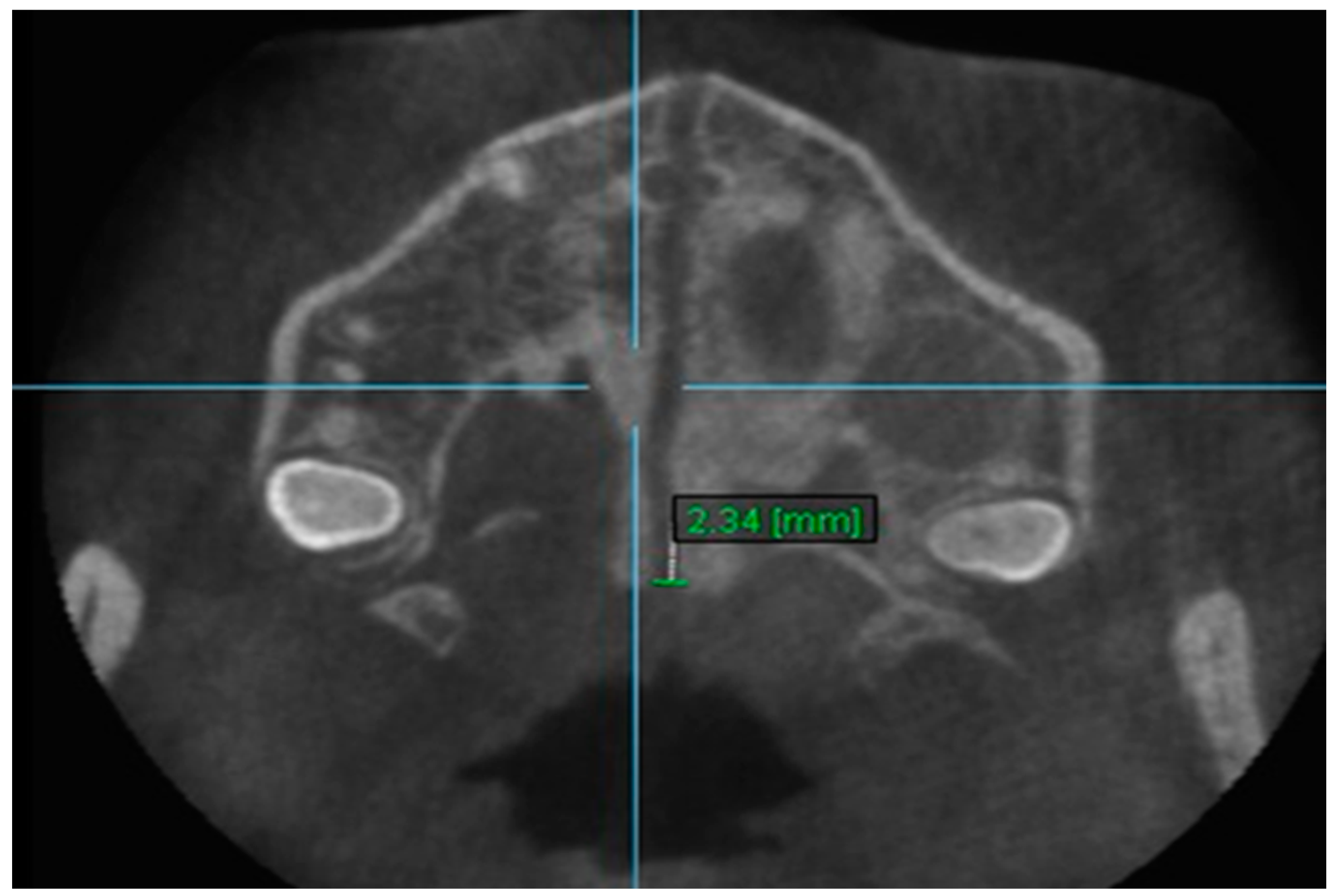 Diagnostics 13 01322 g012 Diagnostics 13 01322 g012