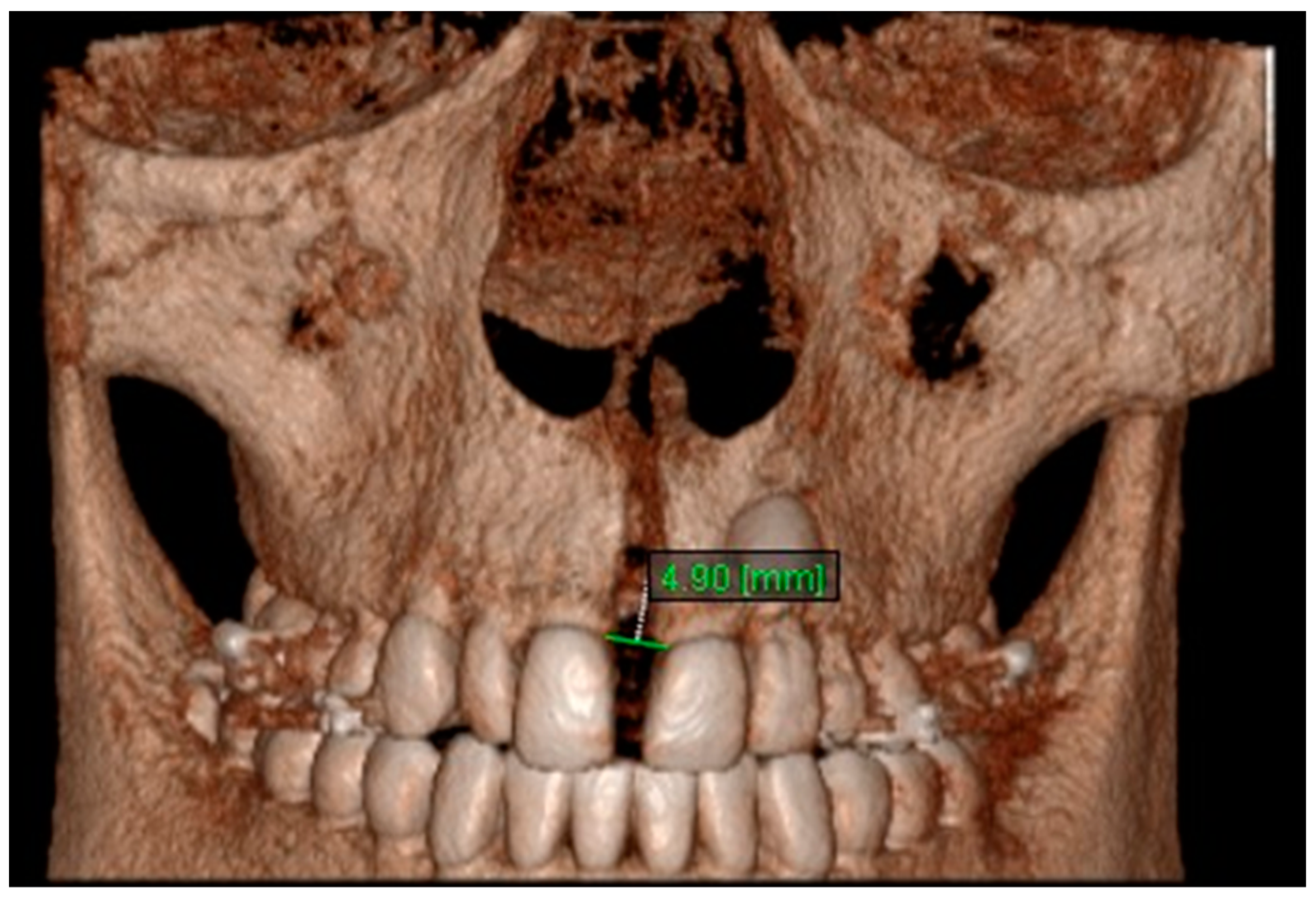 Diagnostics 13 01322 g013 Diagnostics 13 01322 g013
