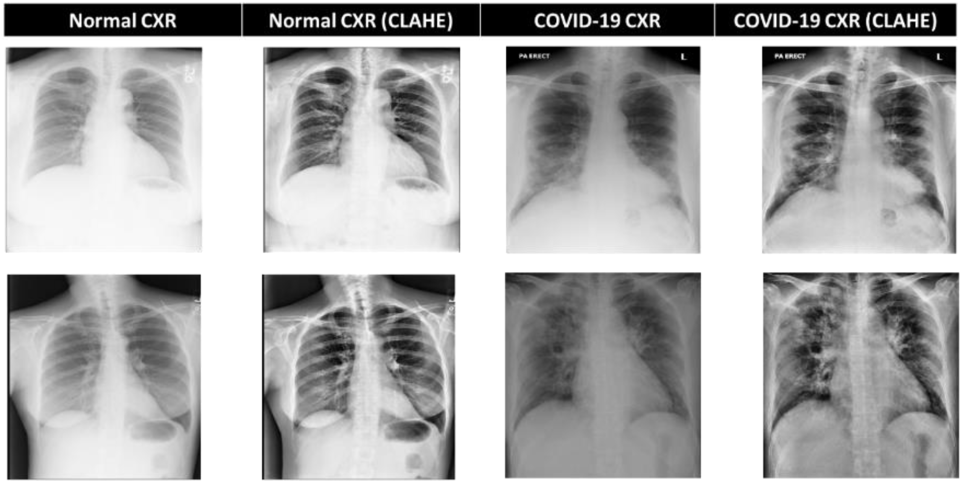 Diagnostics 13 01387 g002 Diagnostics 13 01387 g002
