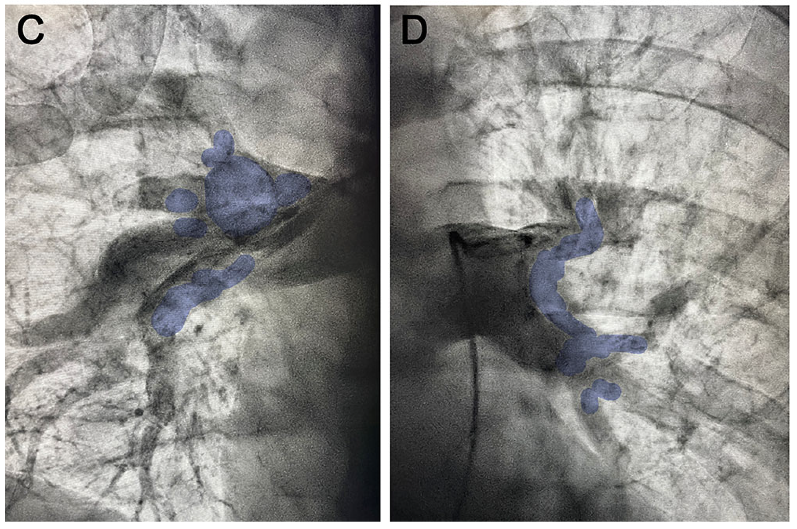 Diagnostics 13 01392 g003b