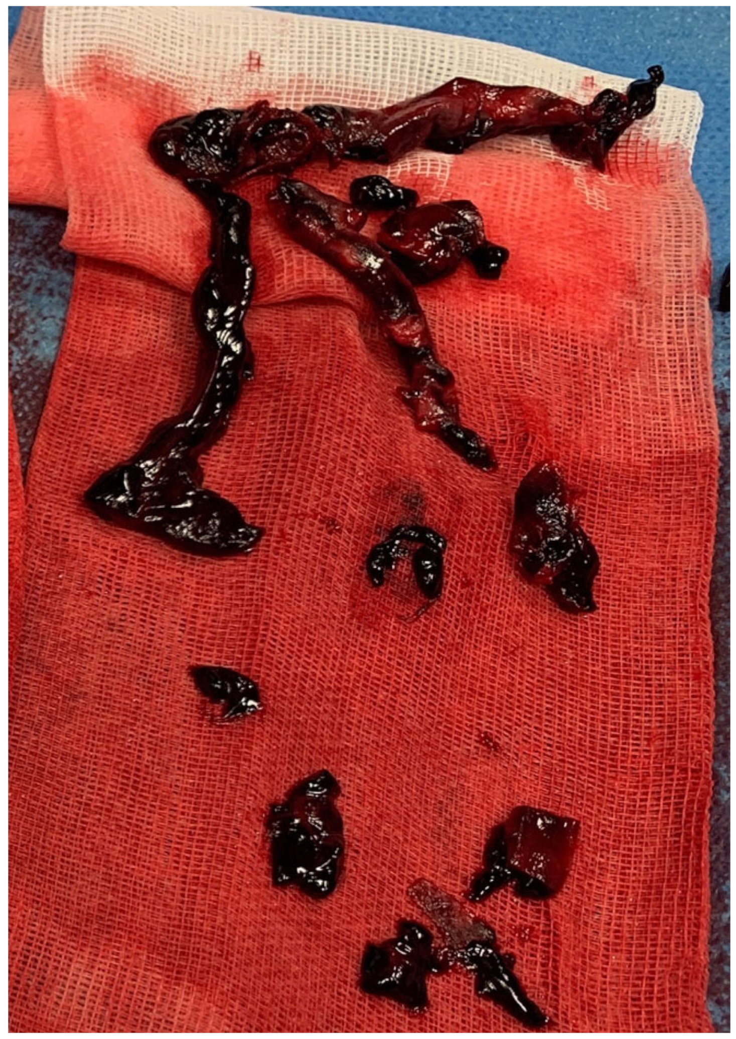 Diagnostics 13 01392 g004