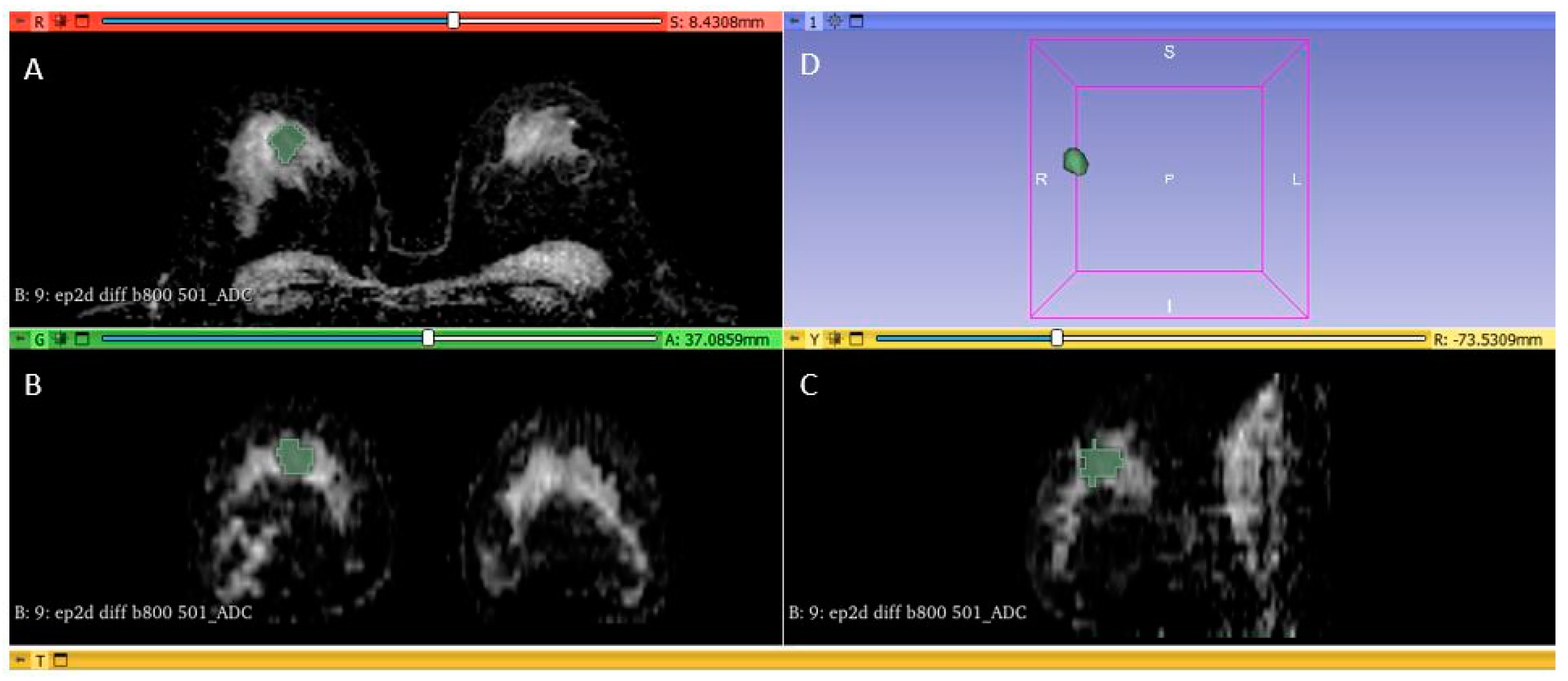 Diagnostics 13 01414 g002 Diagnostics 13 01414 g002