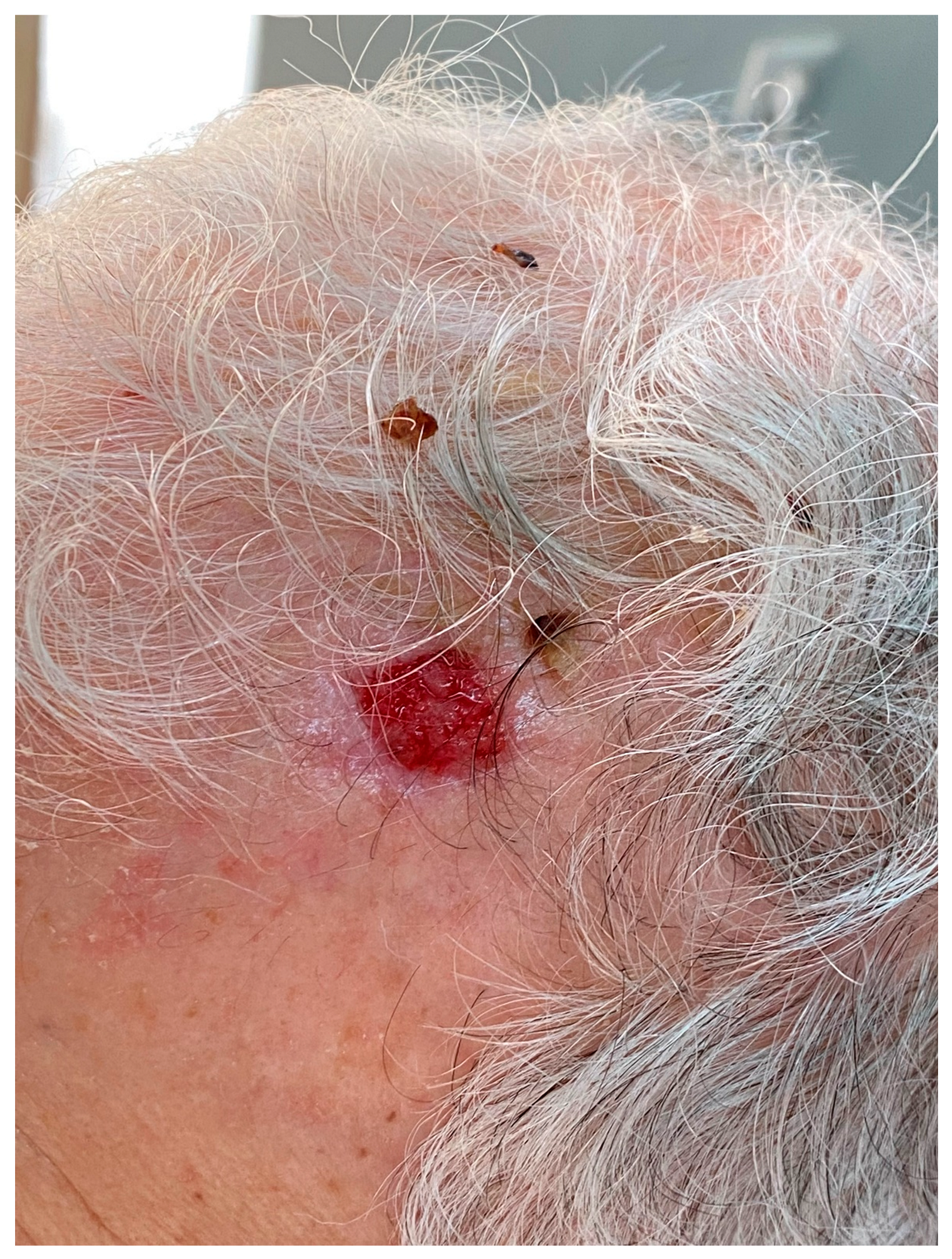 Diagnostics 13 01431 g001 Diagnostics 13 01431 g001