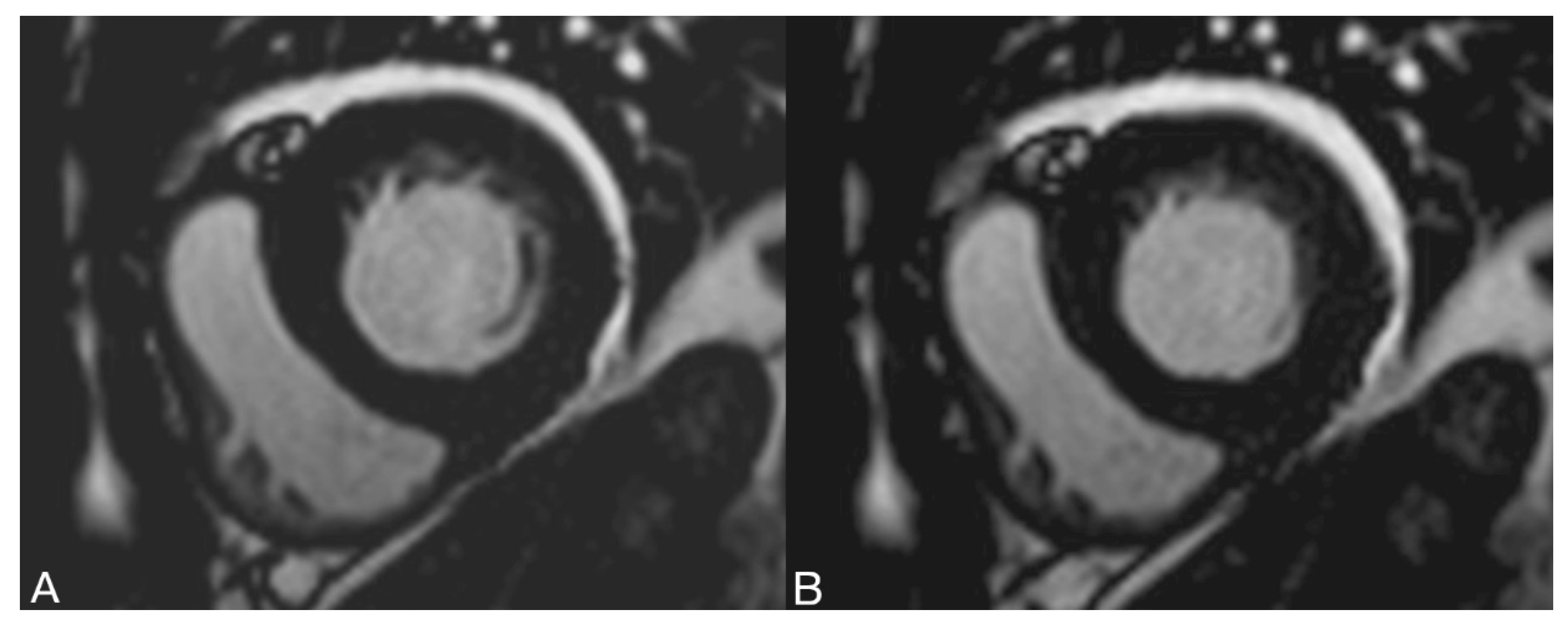 Diagnostics 13 01437 g005 Diagnostics 13 01437 g005