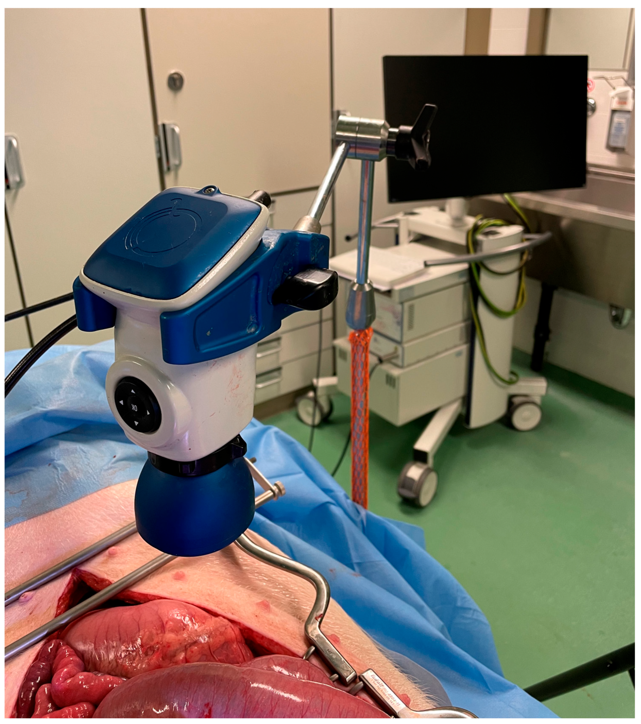 ICG near-infrared fluorescence angiography (using the LUNA system