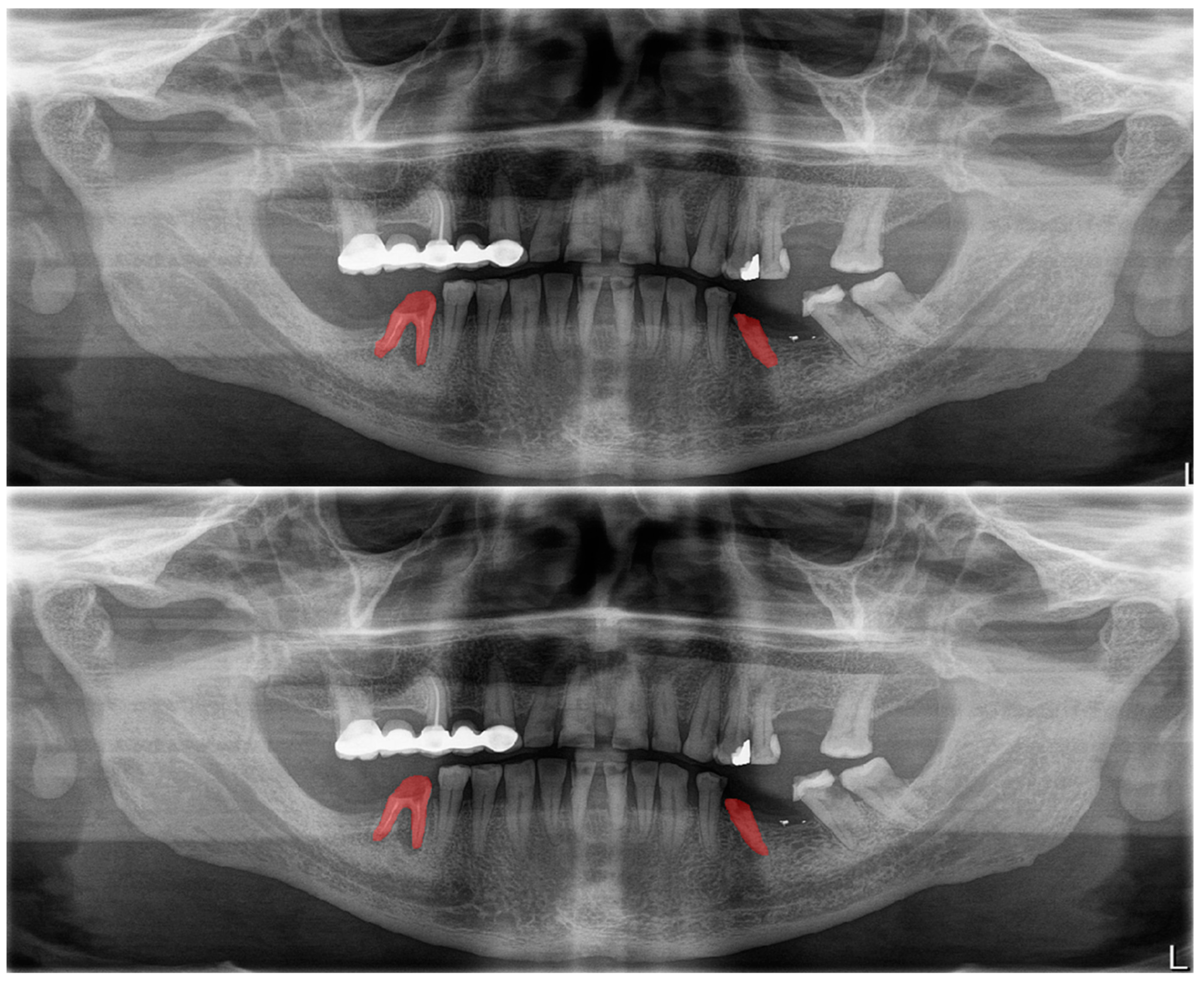 Diagnostics 13 01487 g007 Diagnostics 13 01487 g007