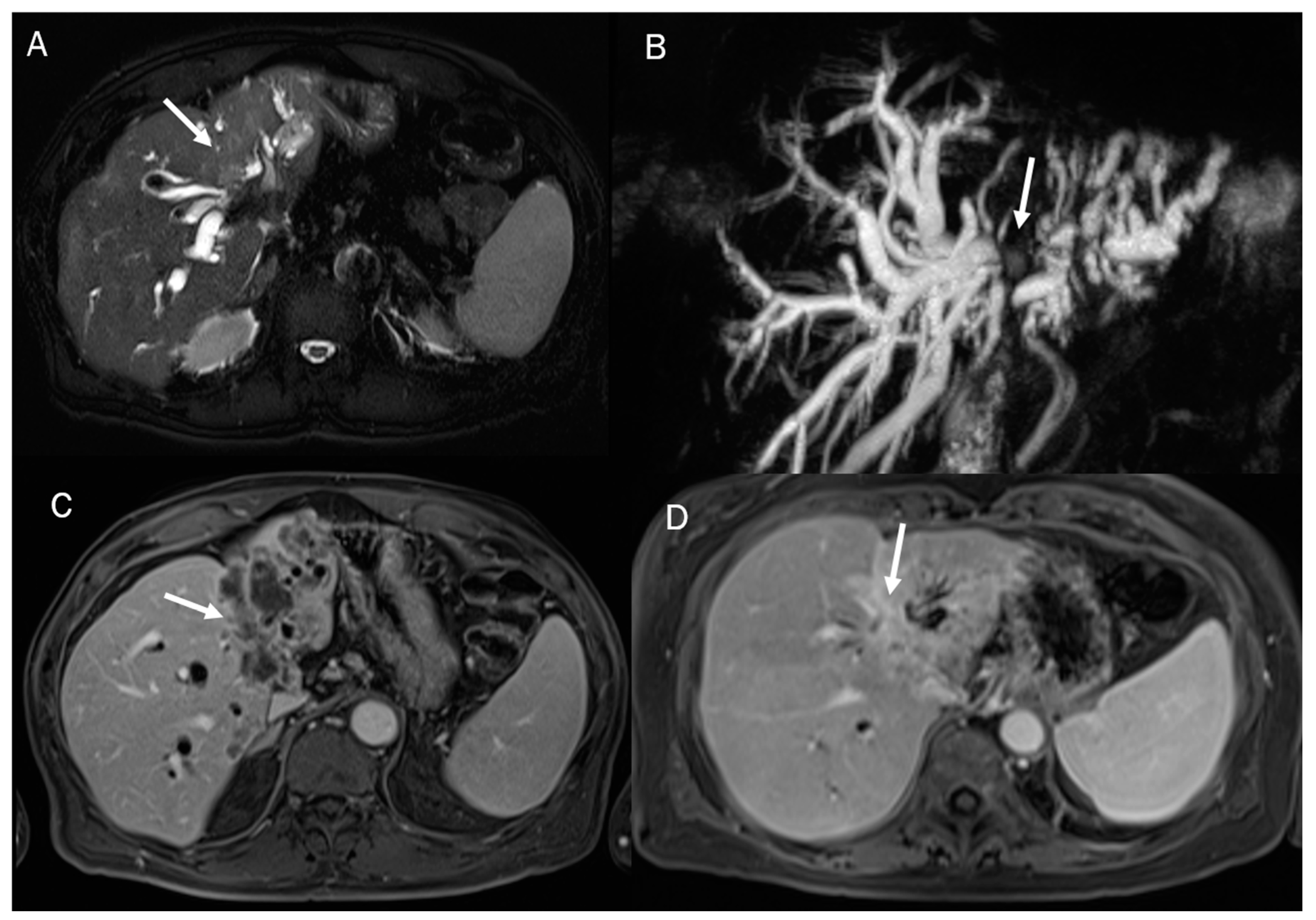 Diagnostics 13 01488 g006 Diagnostics 13 01488 g006