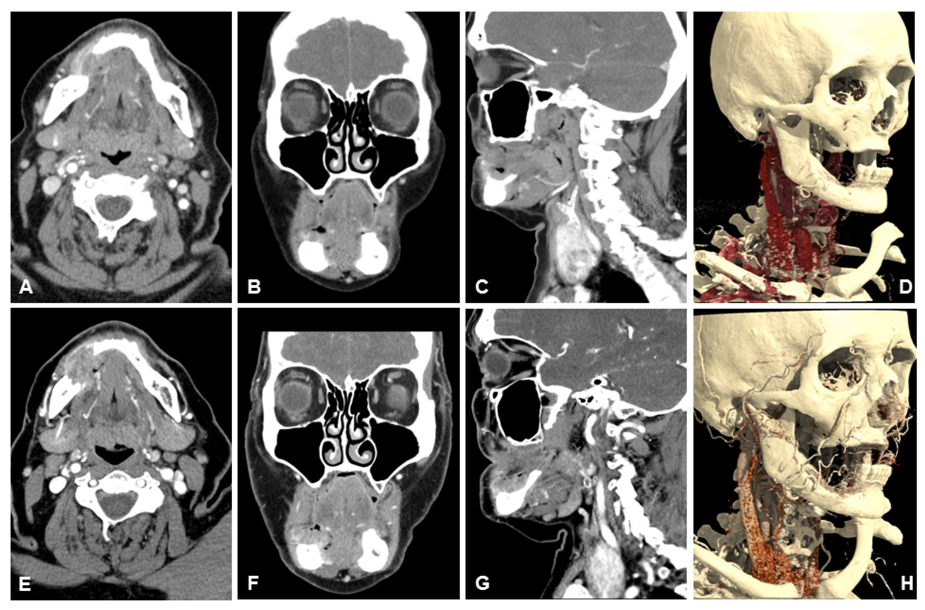 Diagnostics 13 01534 g004 Diagnostics 13 01534 g004