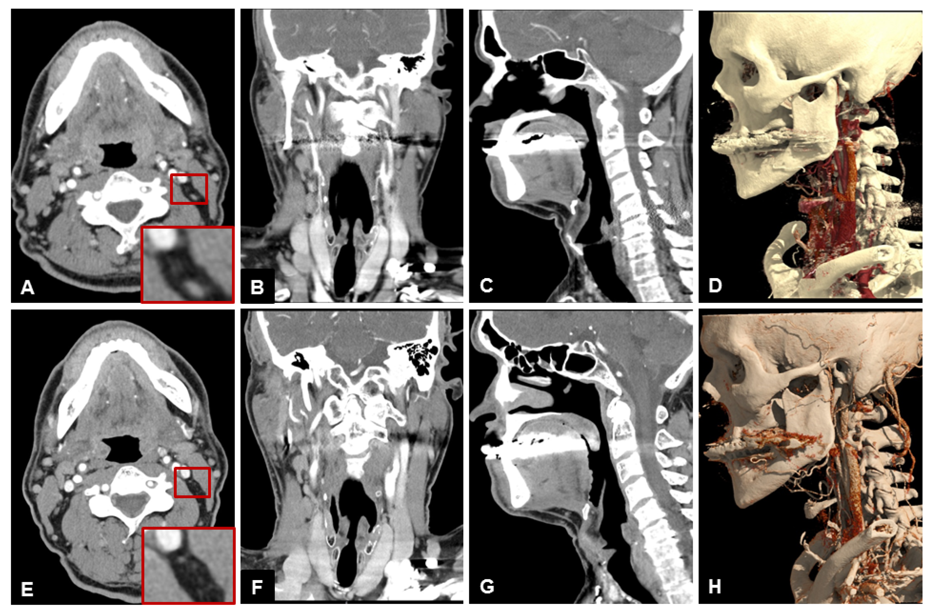 Diagnostics 13 01534 g005 Diagnostics 13 01534 g005