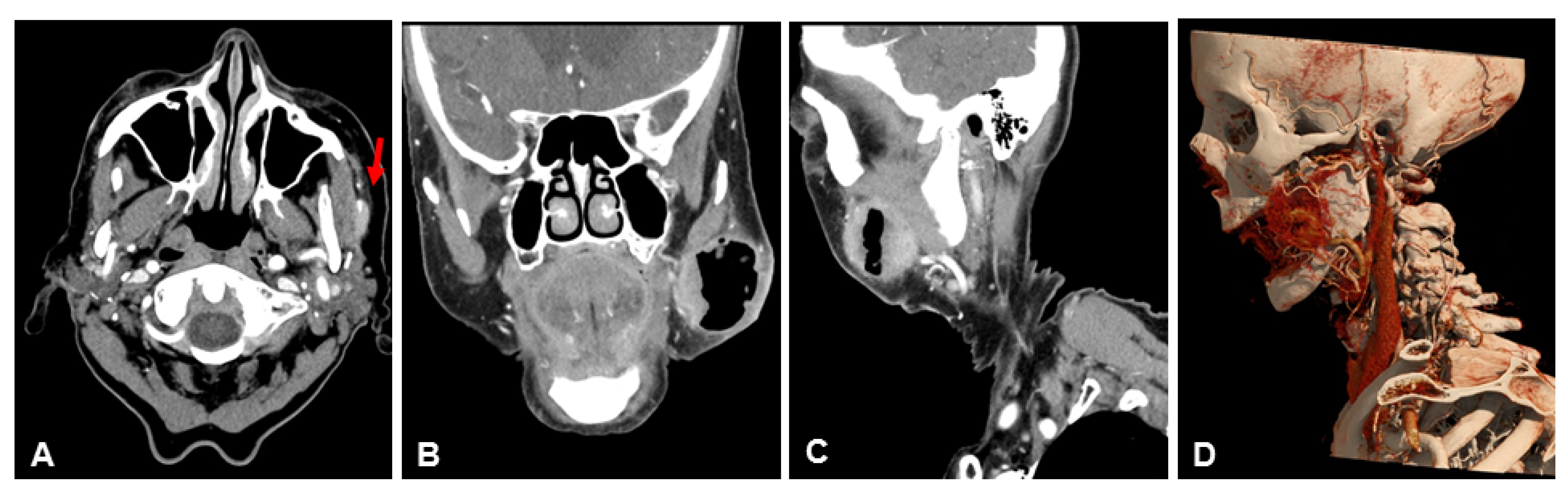 Diagnostics 13 01534 g006 Diagnostics 13 01534 g006