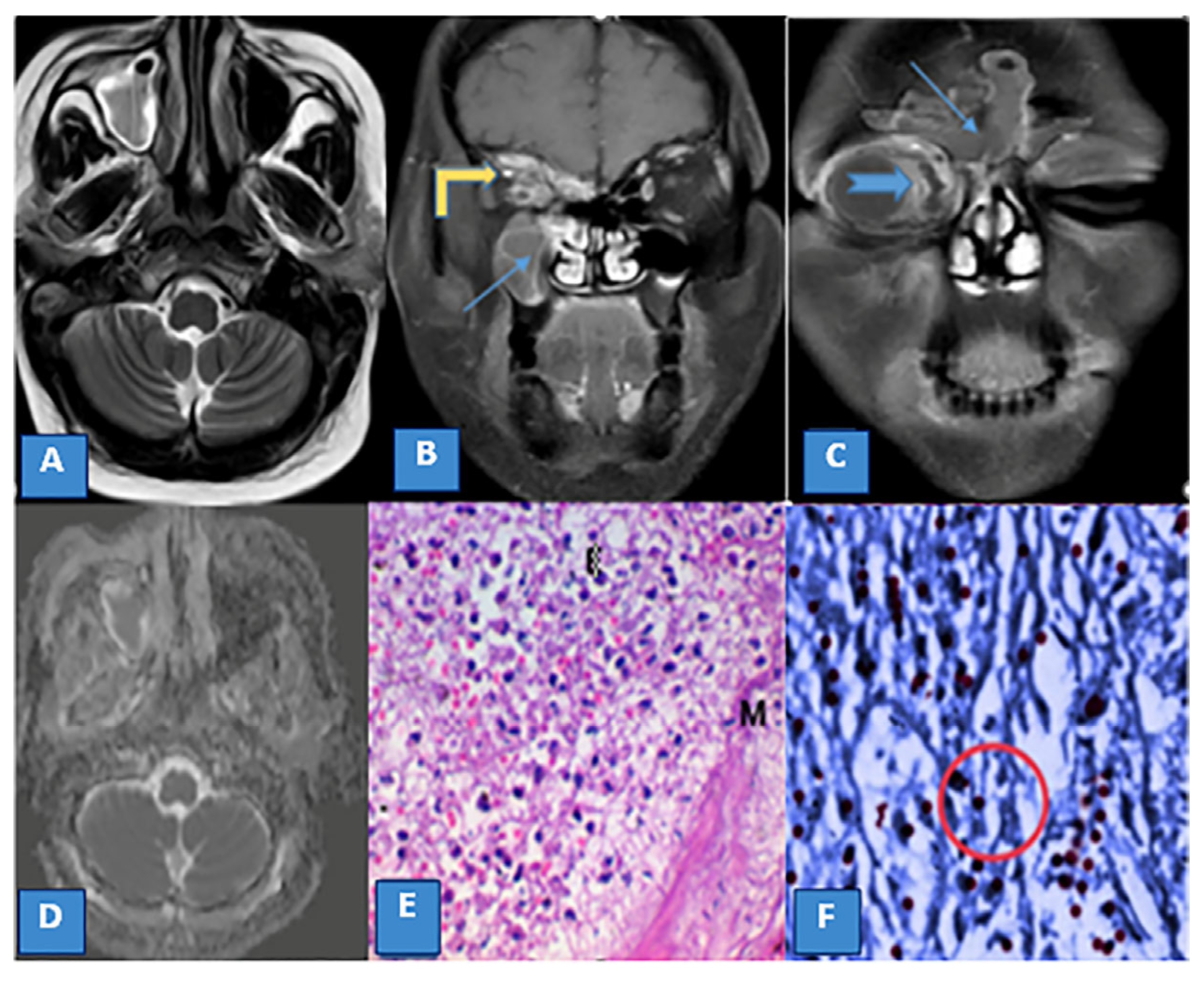 Diagnostics 13 01546 g002 Diagnostics 13 01546 g002