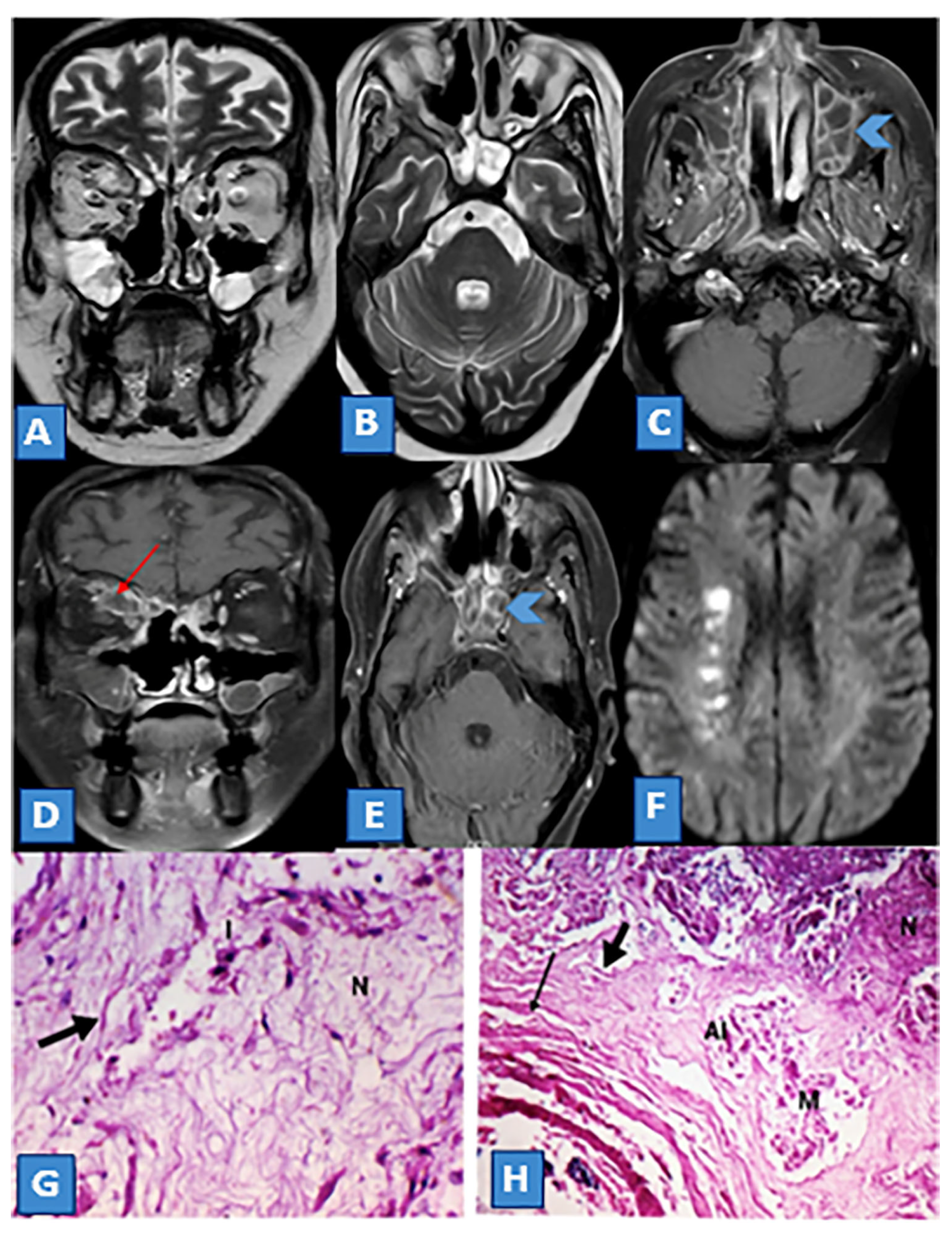 Diagnostics 13 01546 g004 Diagnostics 13 01546 g004