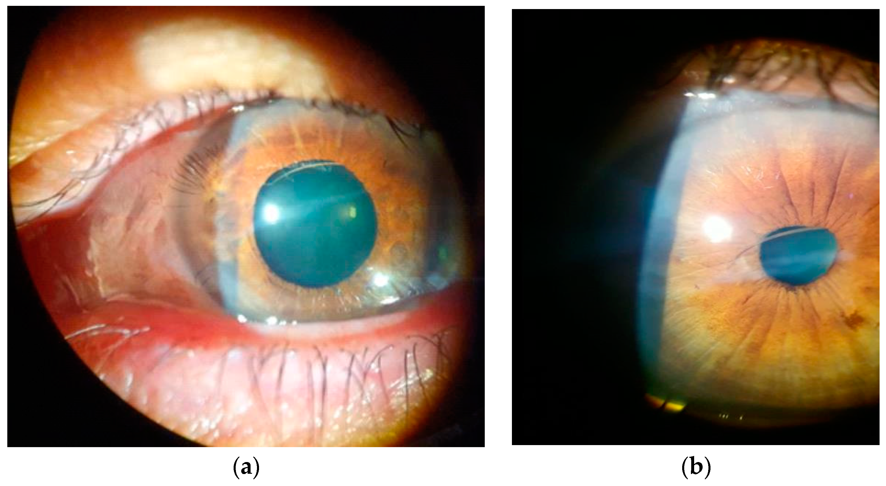 Diagnostics 13 01575 g001 Diagnostics 13 01575 g001