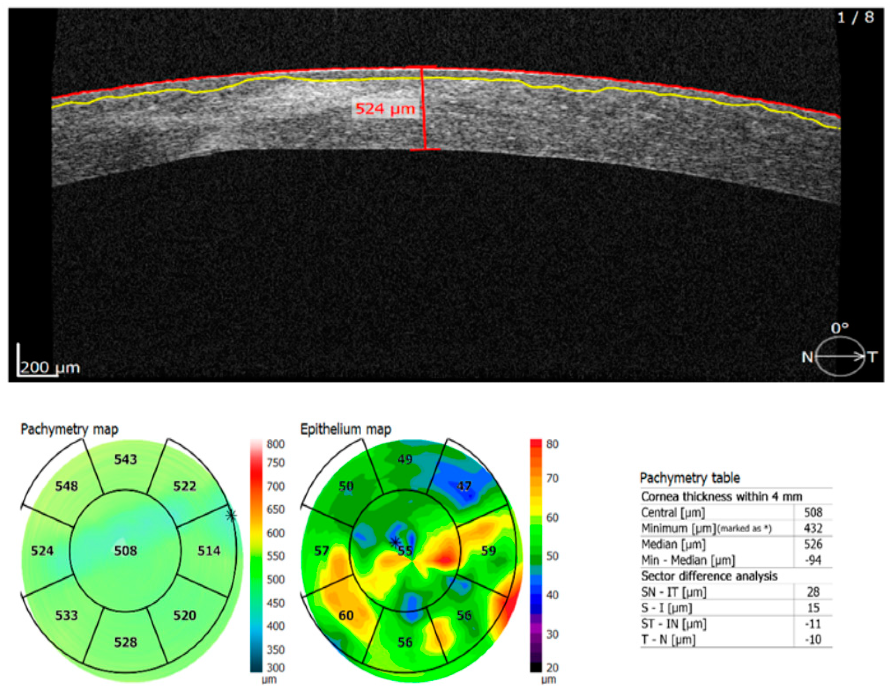 Diagnostics 13 01575 g002 Diagnostics 13 01575 g002