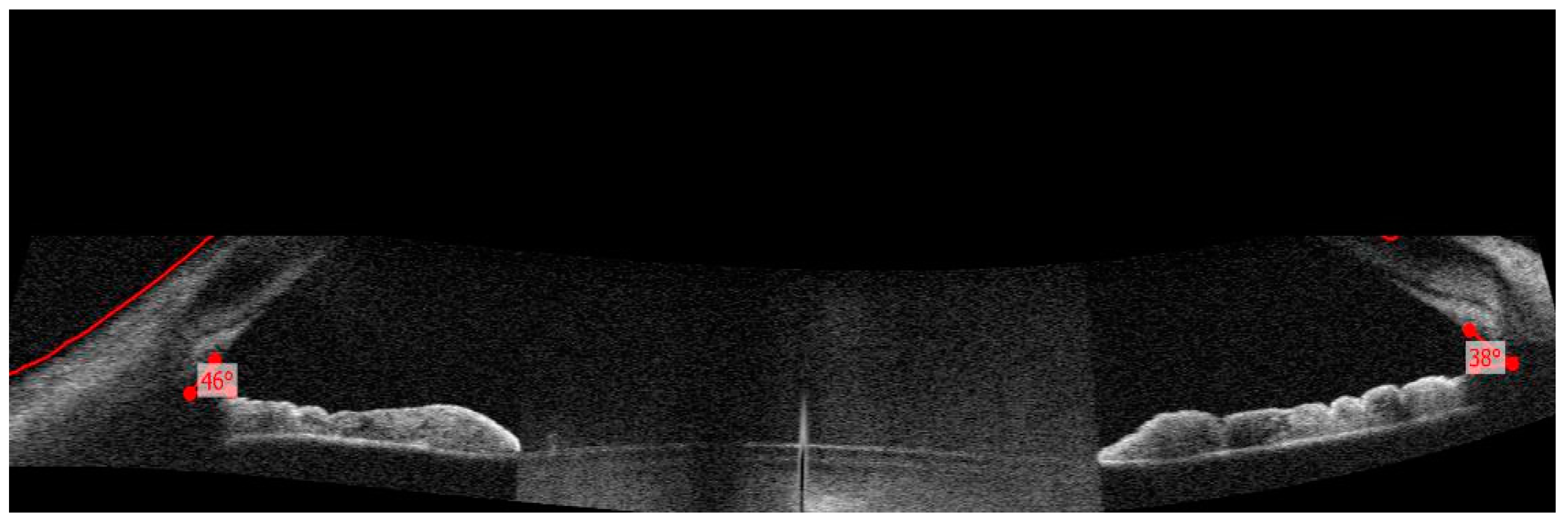 Diagnostics 13 01575 g003 Diagnostics 13 01575 g003