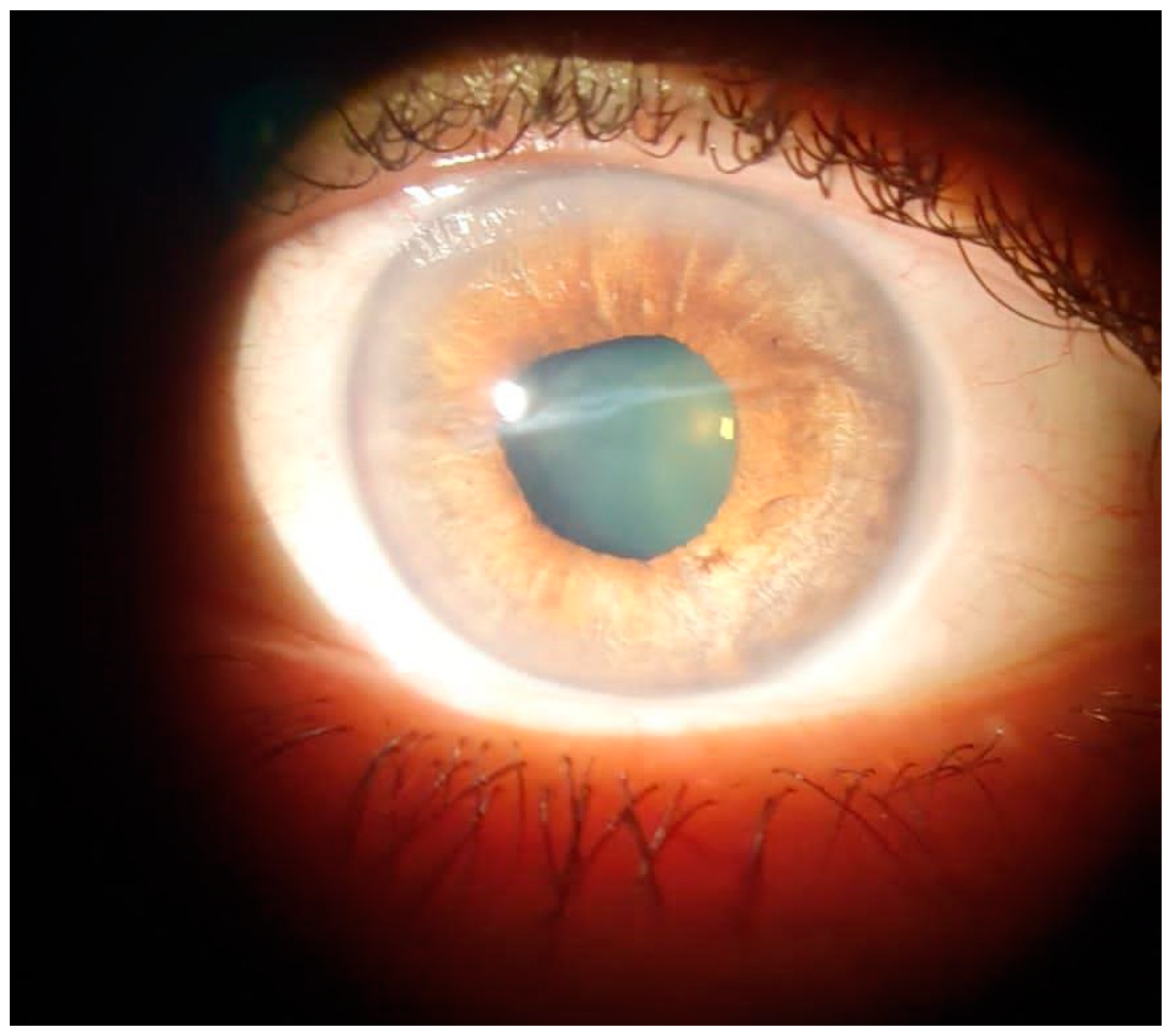 Diagnostics 13 01575 g004 Diagnostics 13 01575 g004