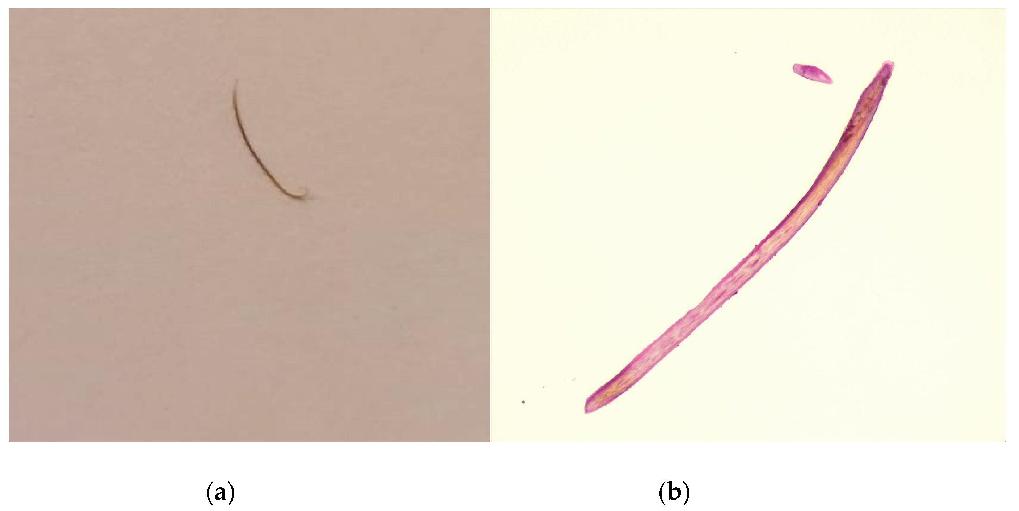 Diagnostics 13 01575 g005 Diagnostics 13 01575 g005