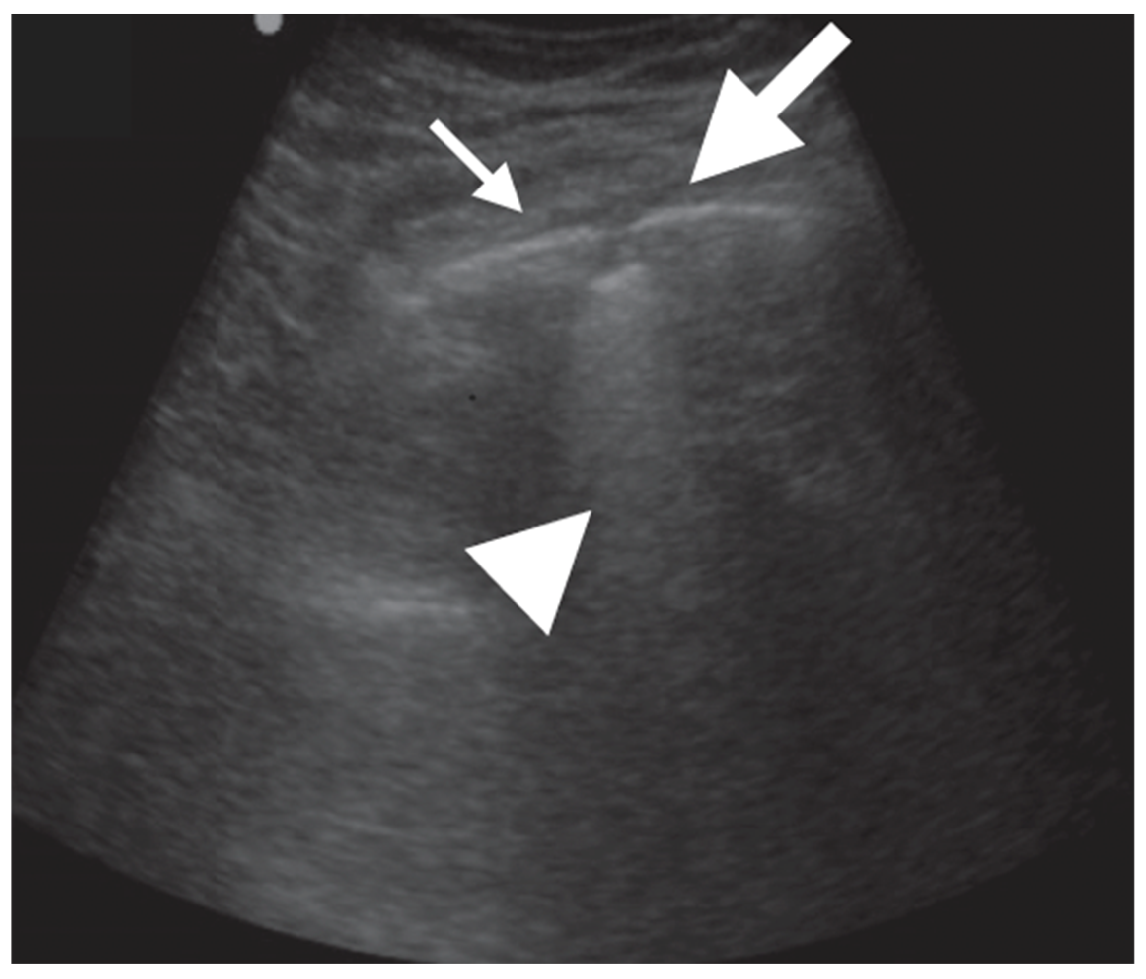 Diagnostics | Free Full-Text | The Role of Ultrasound in the Diagnosis ...