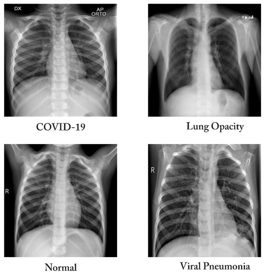 Diagnostics | Free Full-Text | COVID-ConvNet: A Convolutional Neural ...