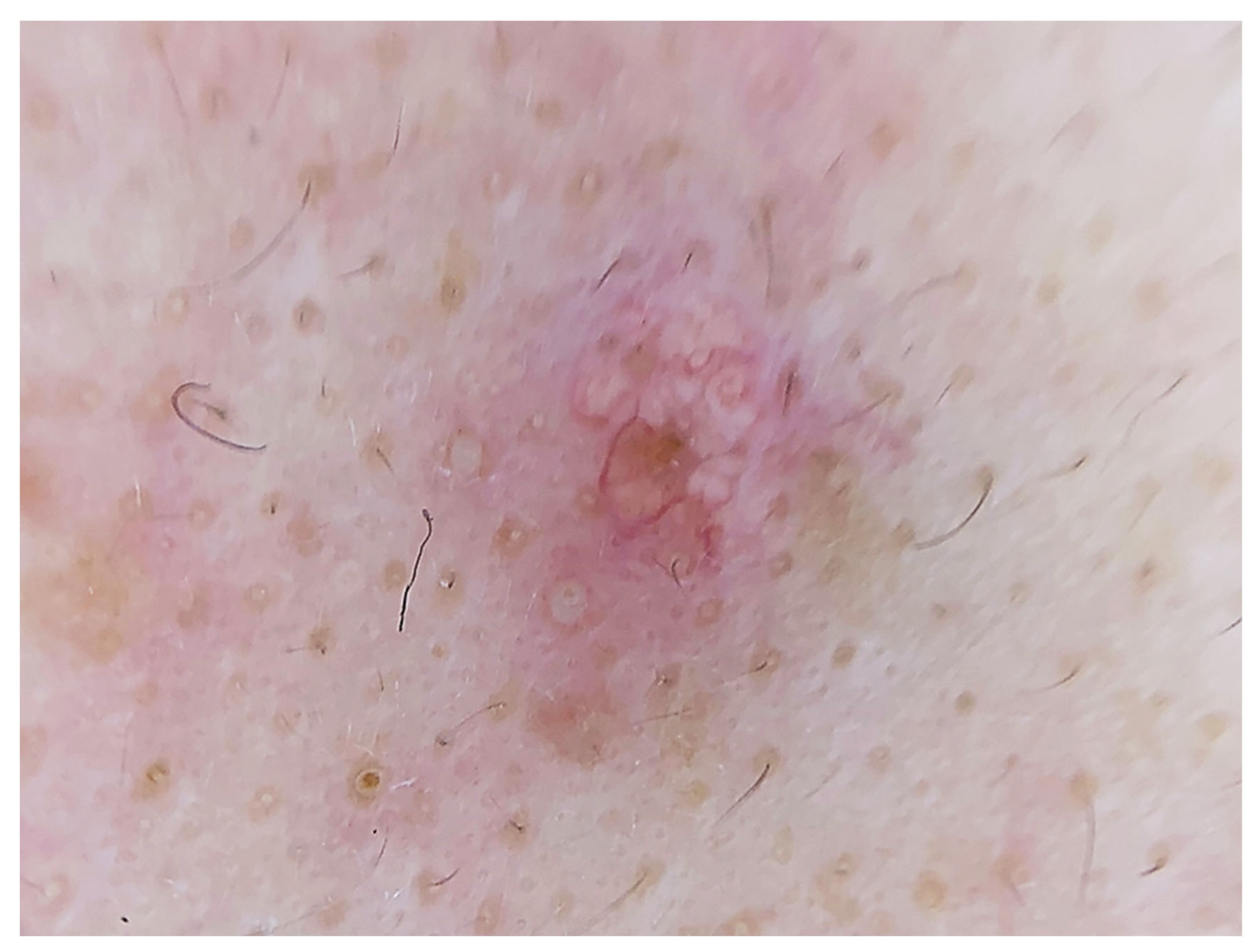 Diagnostics 13 01676 g004 Diagnostics 13 01676 g004