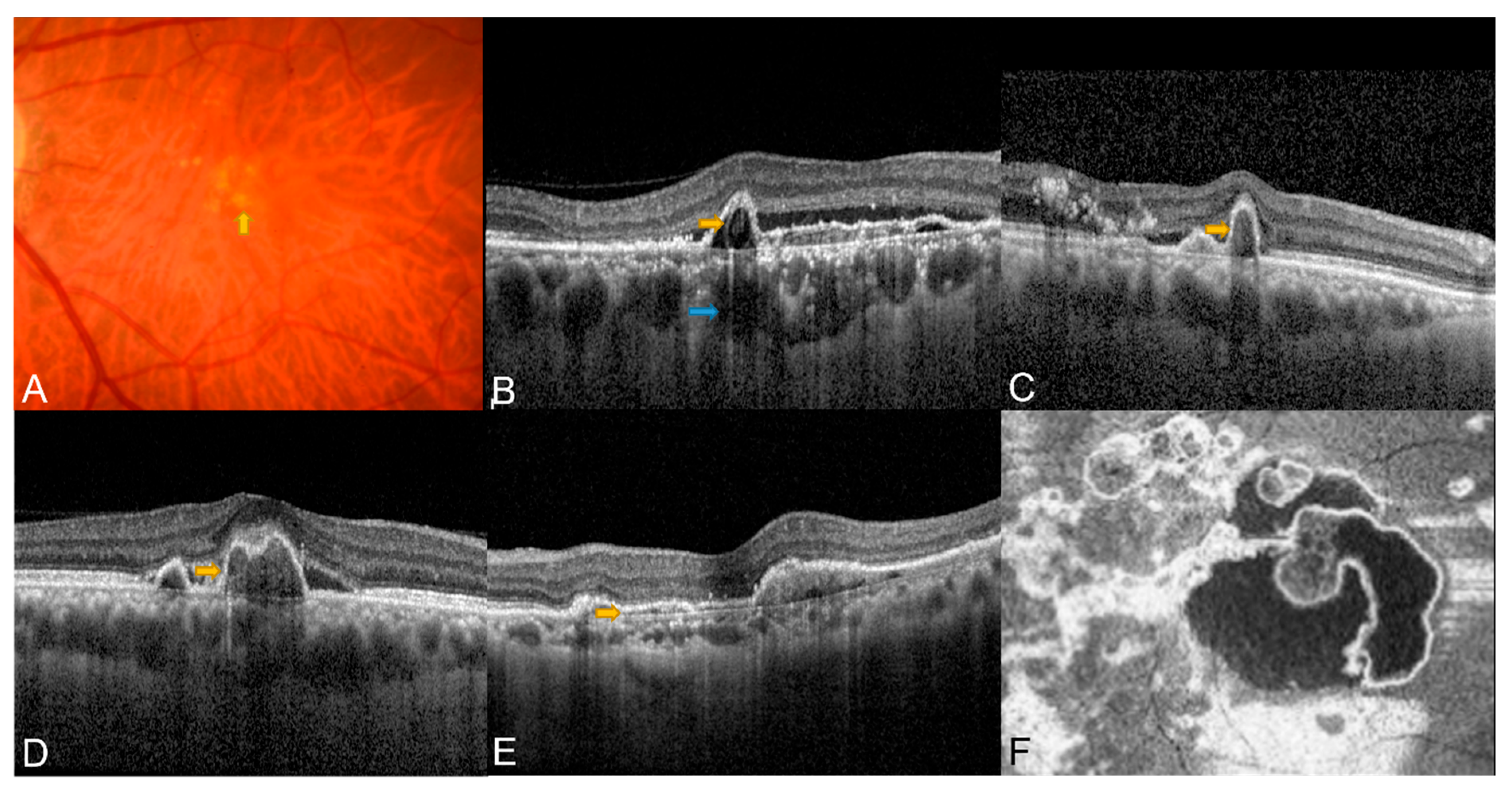 Diagnostics 13 01680 g001 Diagnostics 13 01680 g001