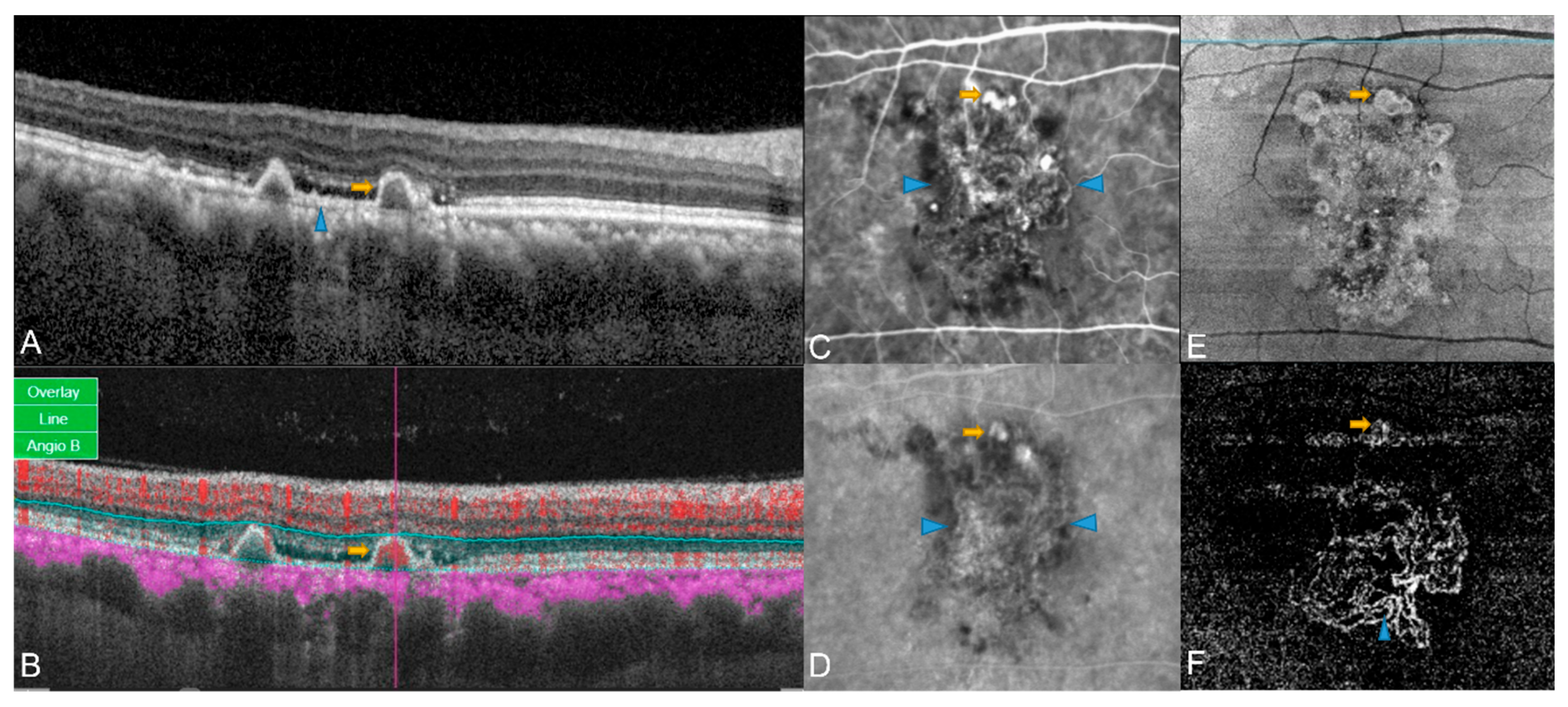 Diagnostics 13 01680 g002 Diagnostics 13 01680 g002
