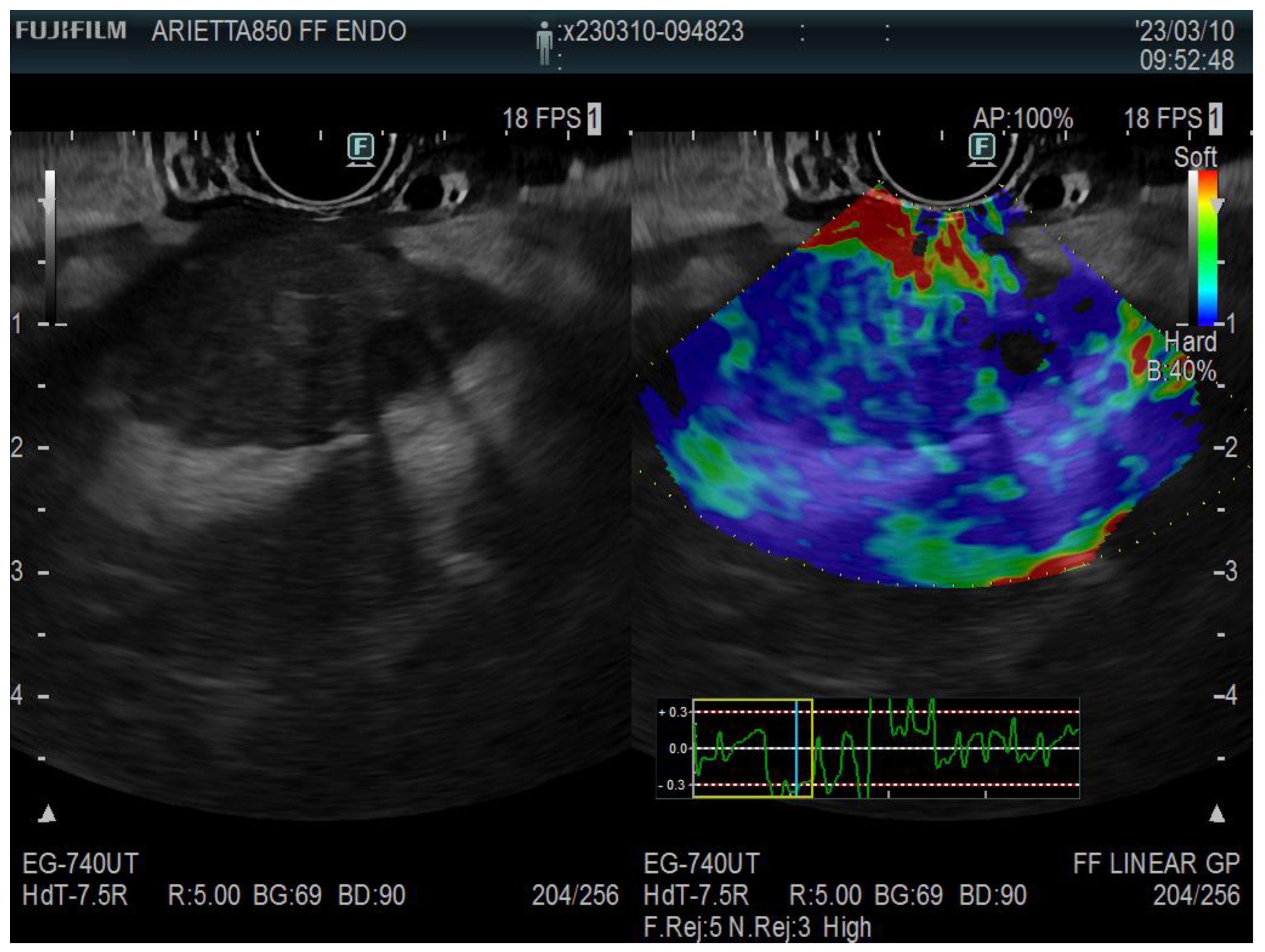 Diagnostics 13 01686 g004 Diagnostics 13 01686 g004